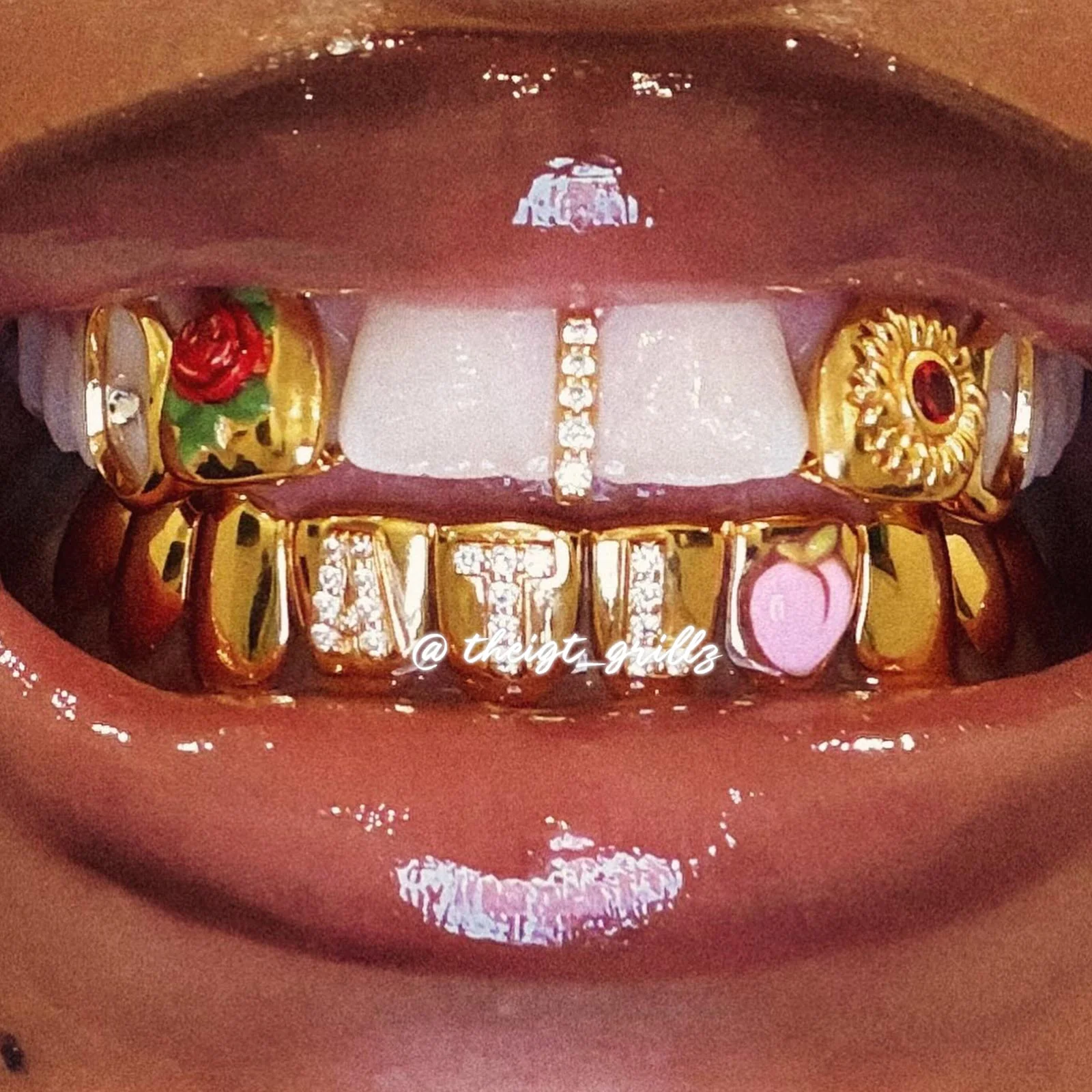 ATL Bloom Grillz - Image 7