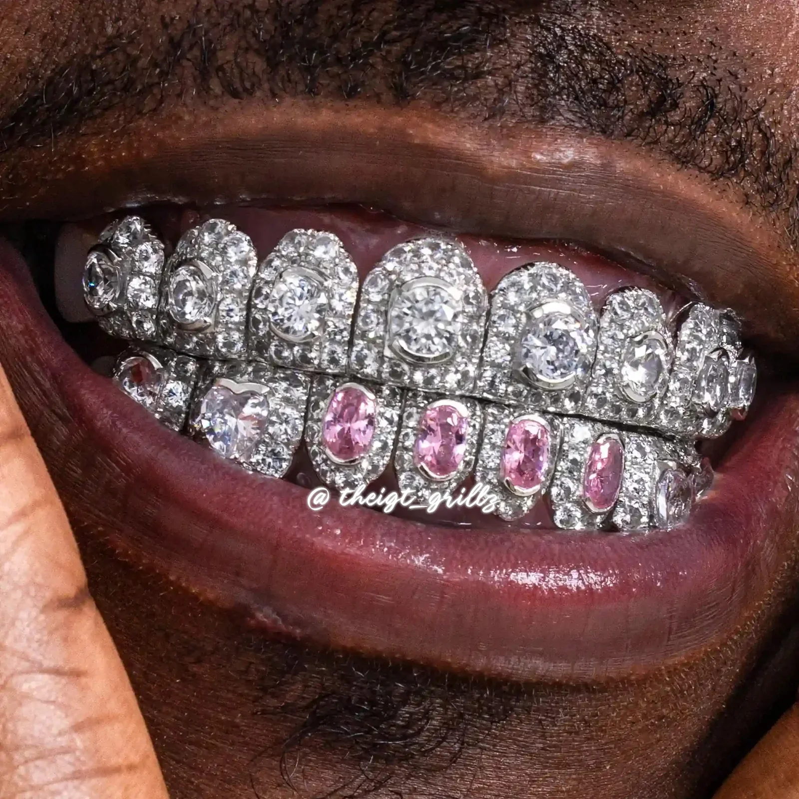 Big Pointer Set Pink Oval Cut & Heart Diamond On Fang Grillz - Image 4