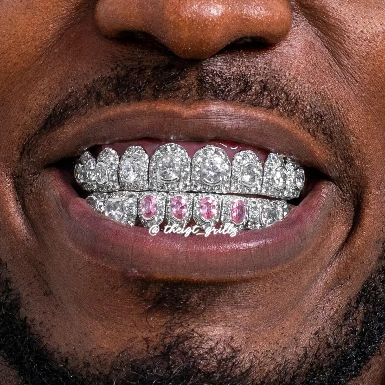 Big Pointer Set Pink Oval Cut & Heart Diamond On Fang Grillz - Image 5
