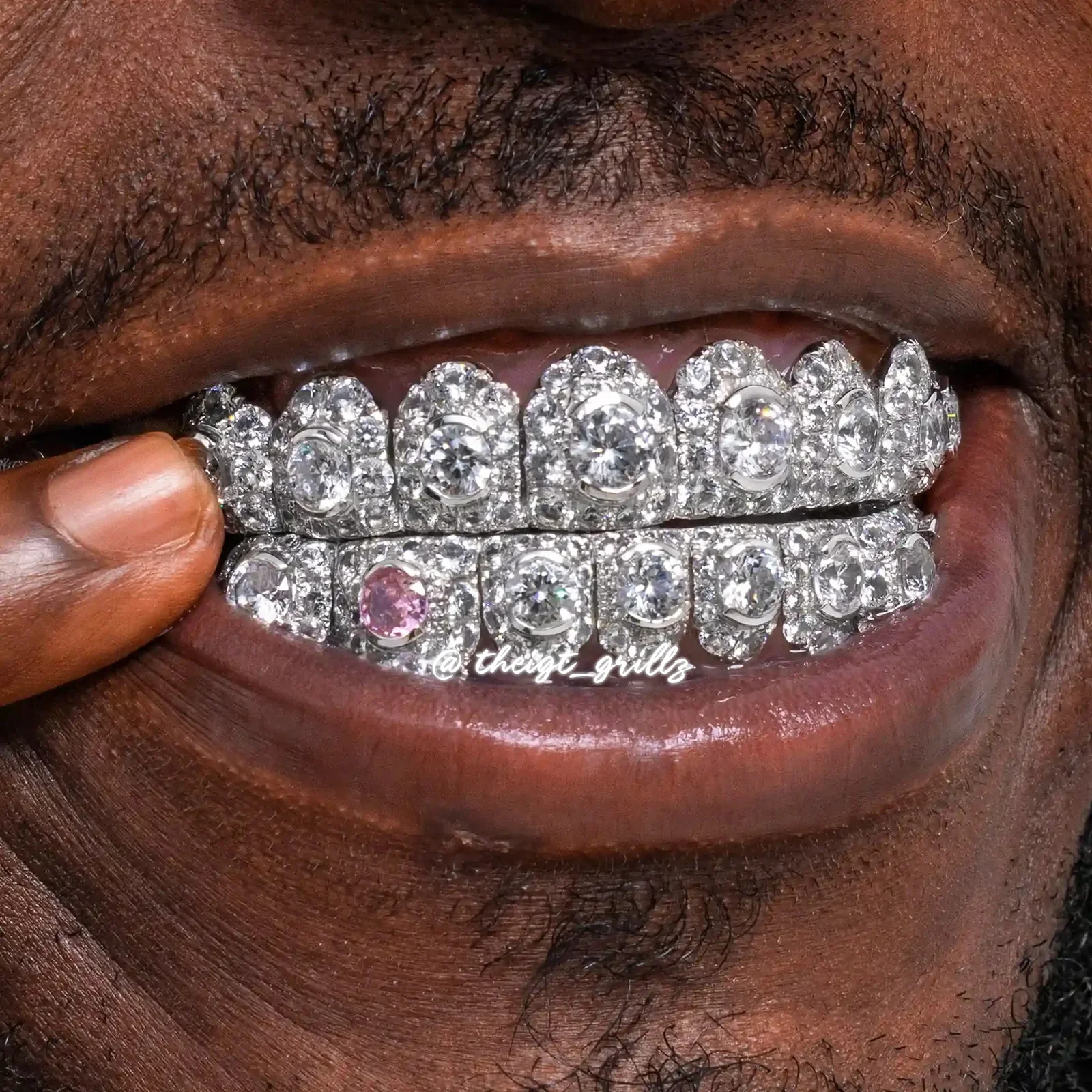 Big Pointer Set Round Cut Diamond Grillz - Image 9