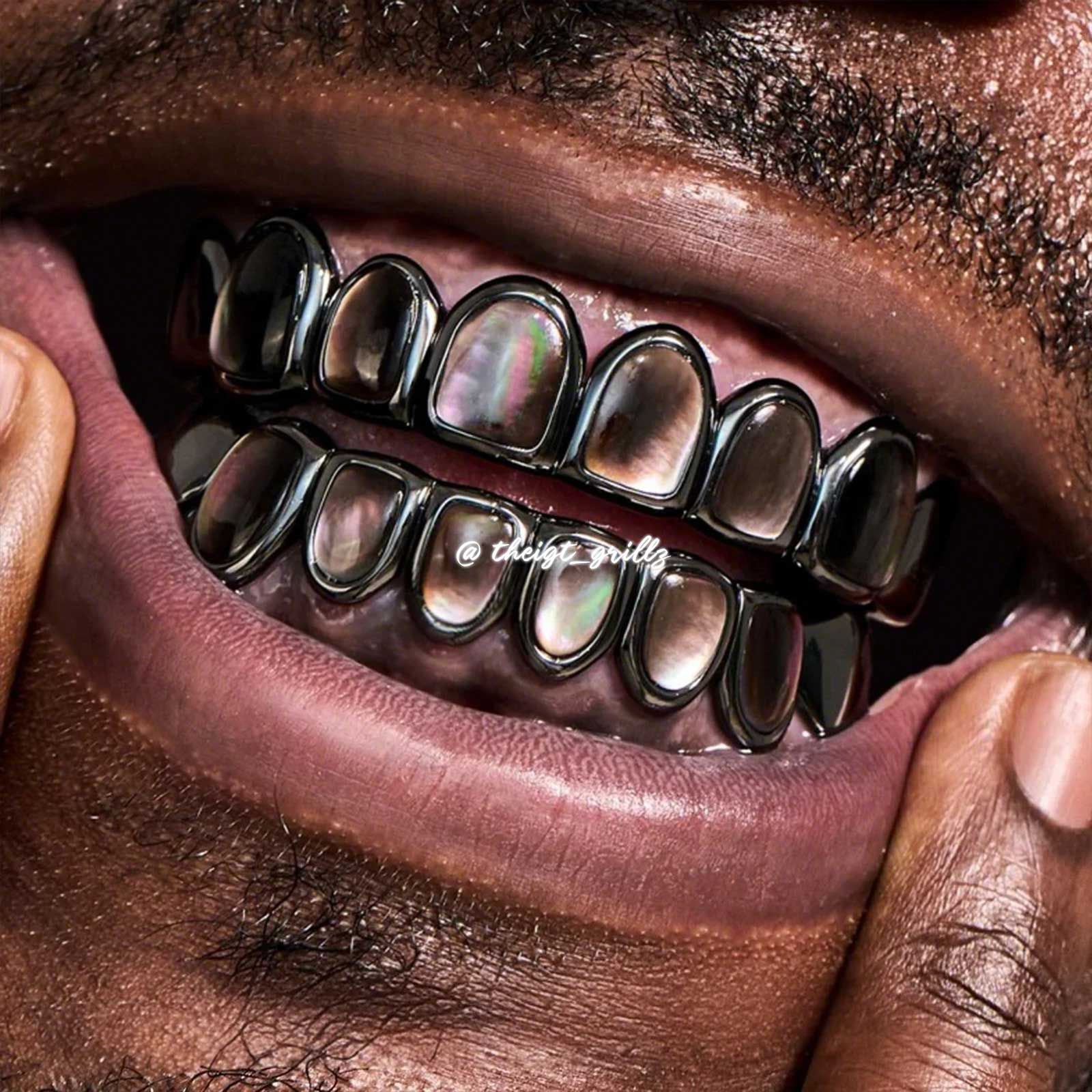 Black Shell Grillz - Image 4