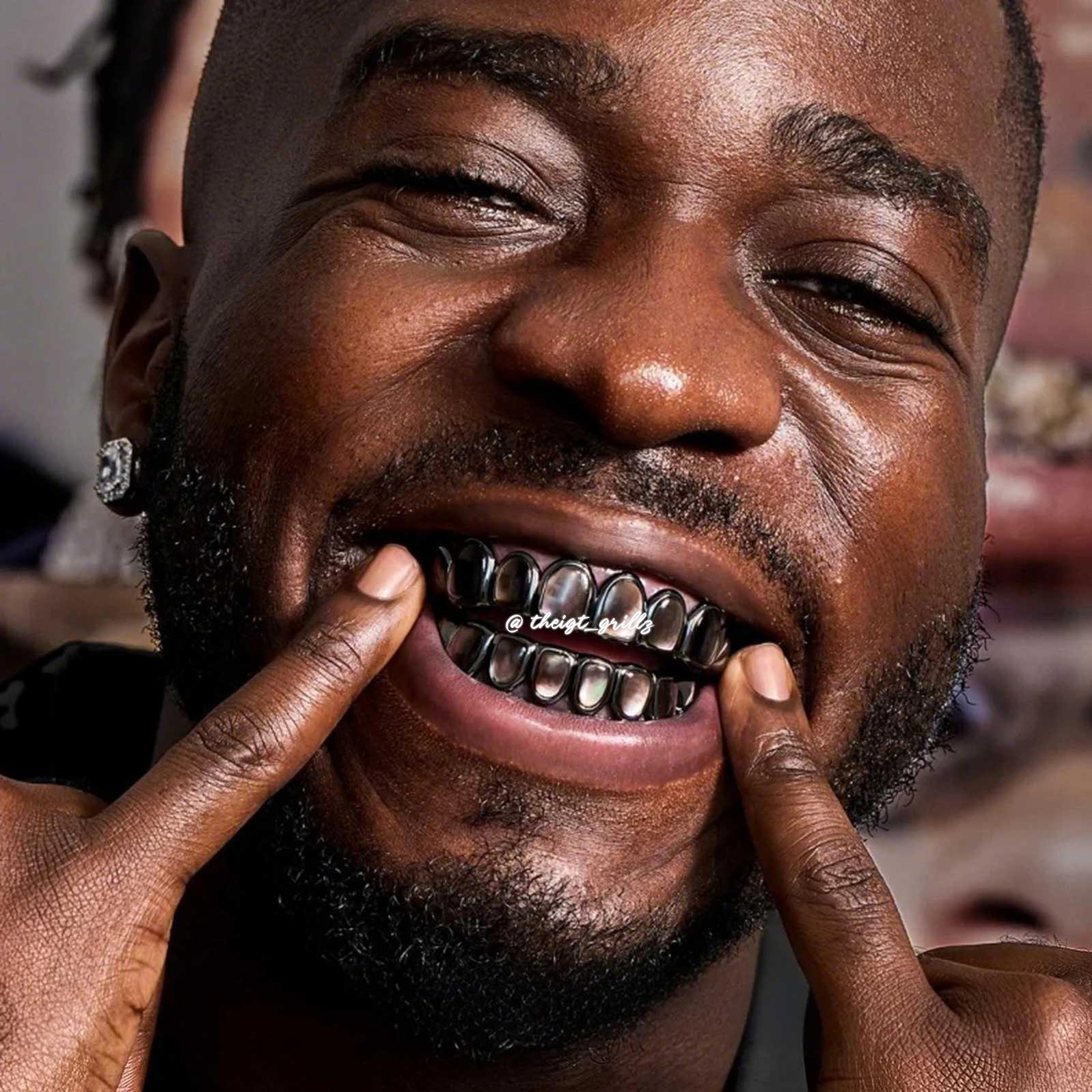 Black Shell Grillz - Image 5