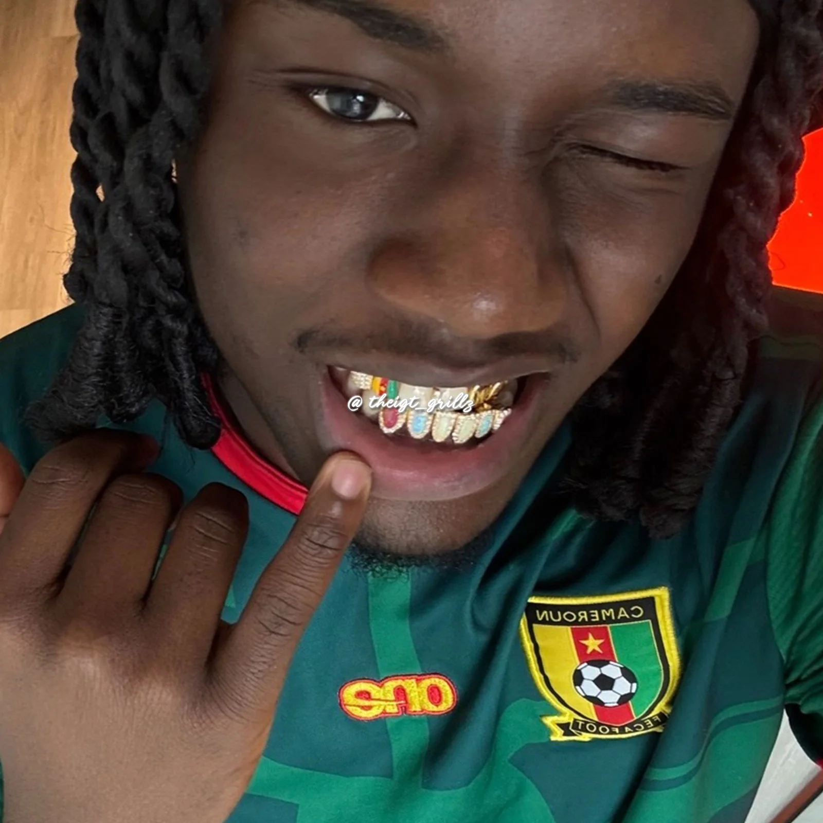 Cameroon Pride & Opal Grillz - Image 8
