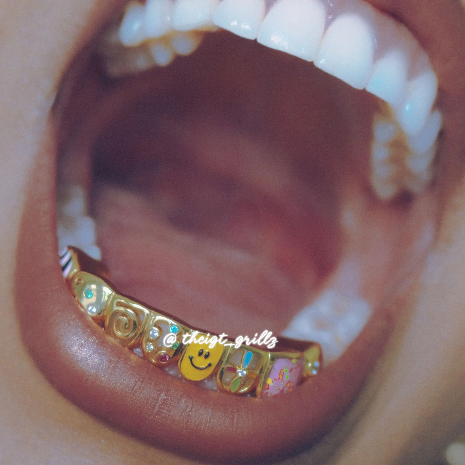 Colorful Enamel Floral Grillz - Image 9