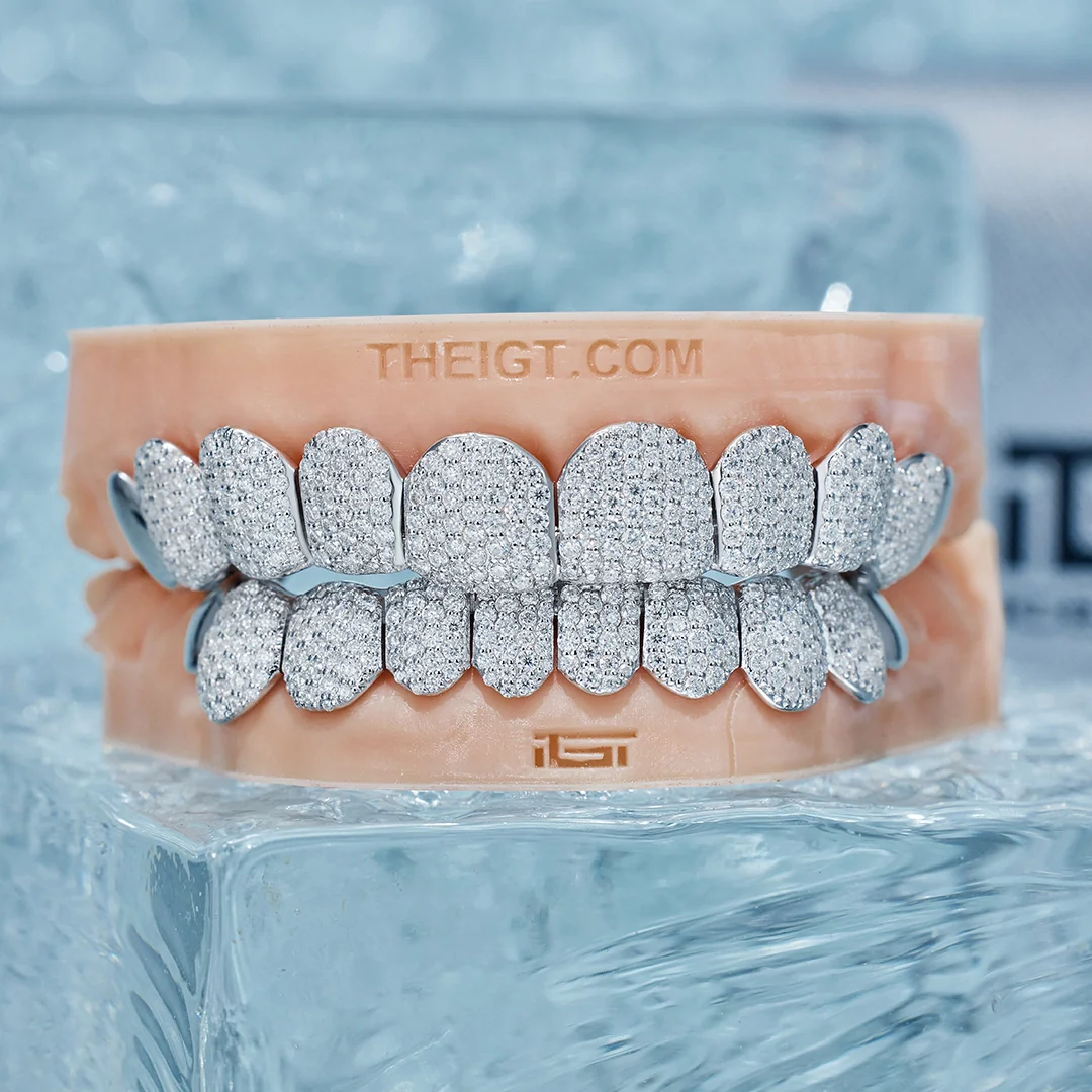 Custom End Capped Moissanite Grillz - Image 2