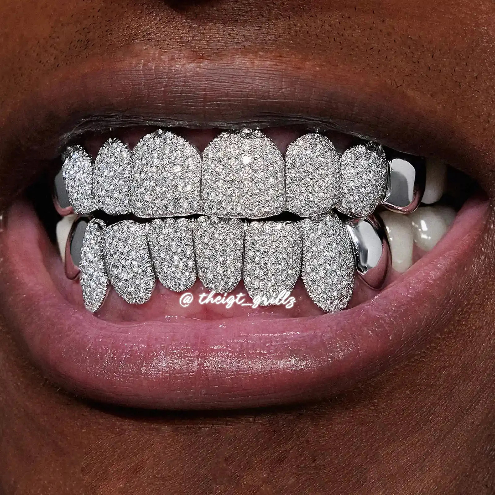 Custom End Capped Moissanite Grillz - Image 9