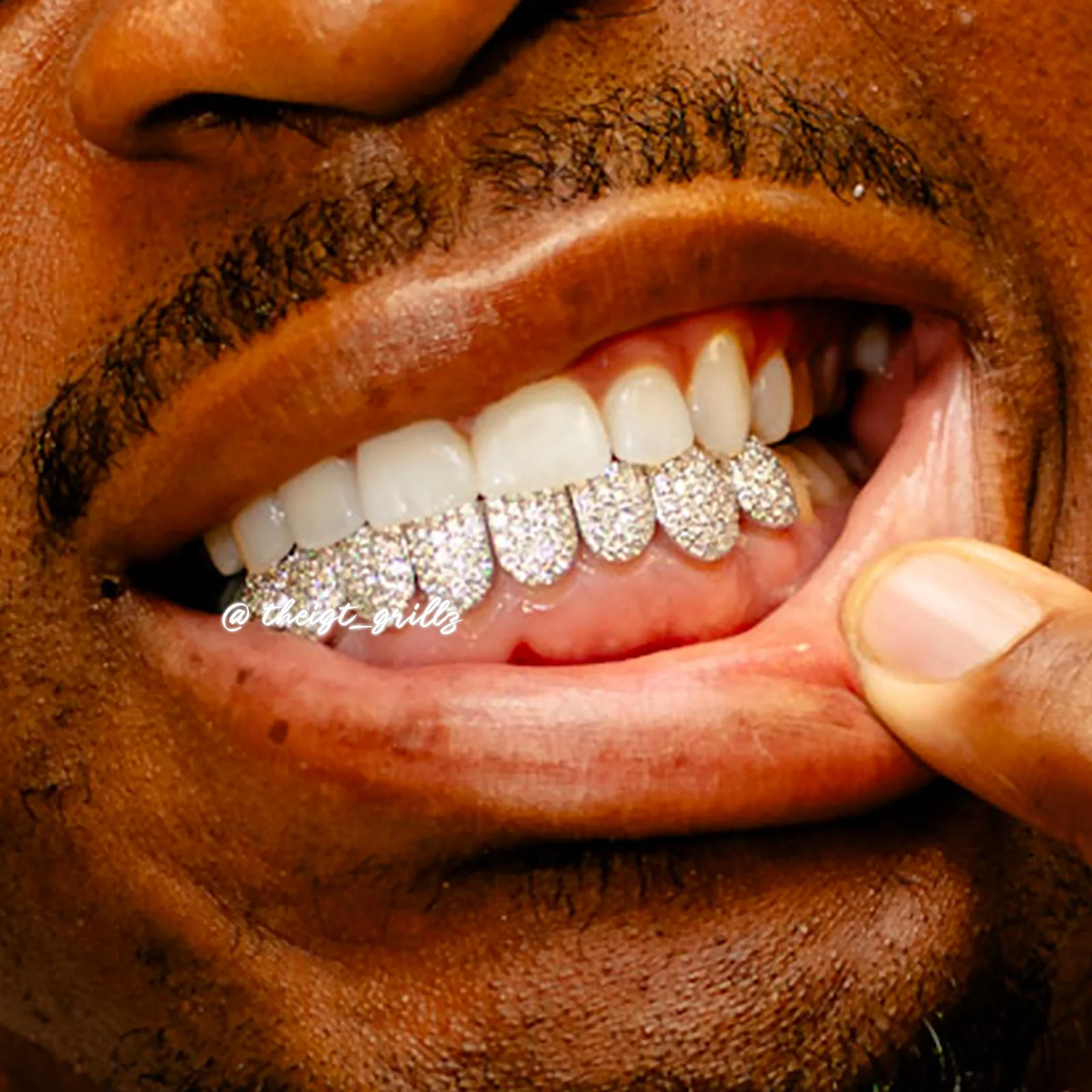 Custom Fully Iced Honeycomb Rimless Setting Grillz - Image 6