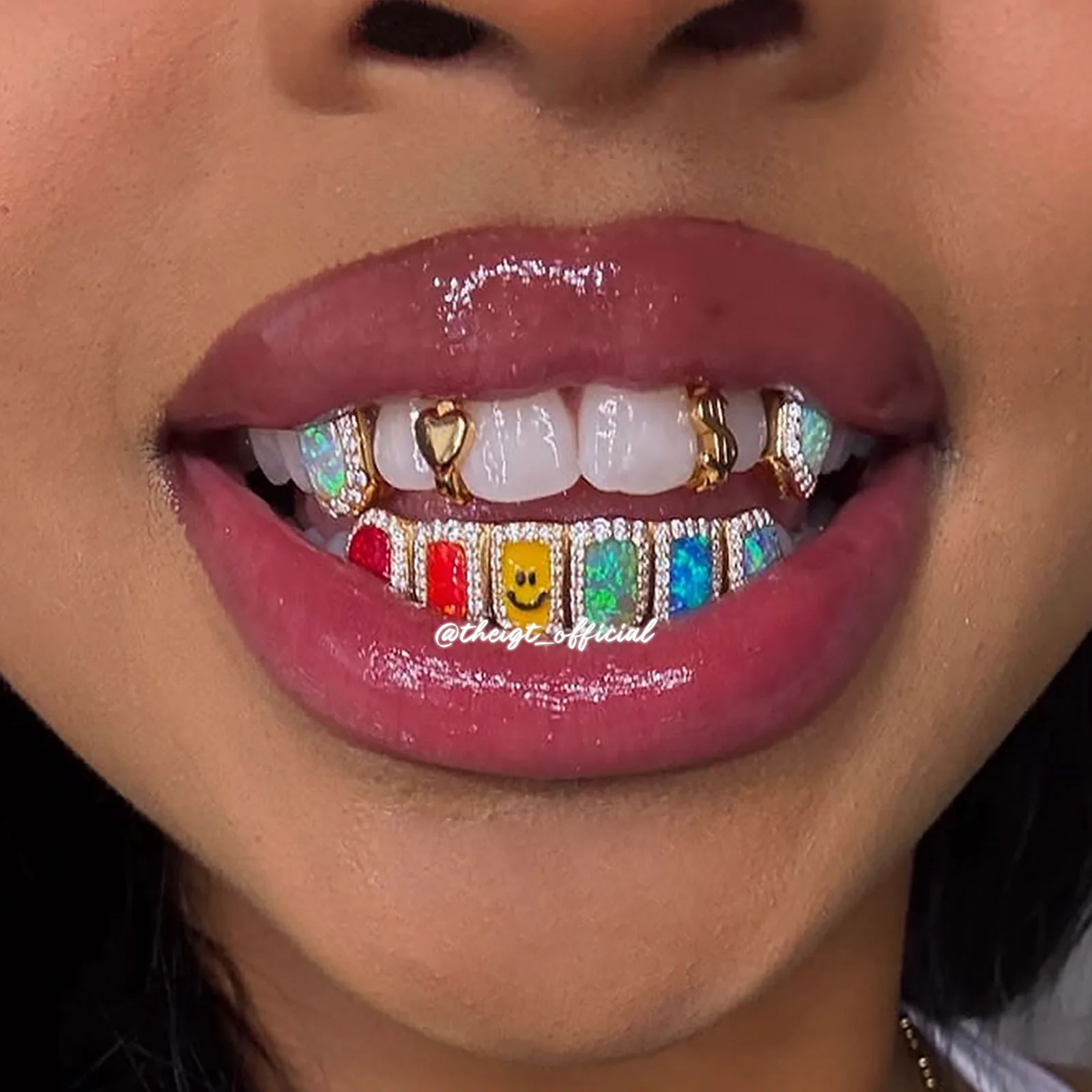 Custom Gap Bar & Colored Opal W Smile Face Grillz - Image 12
