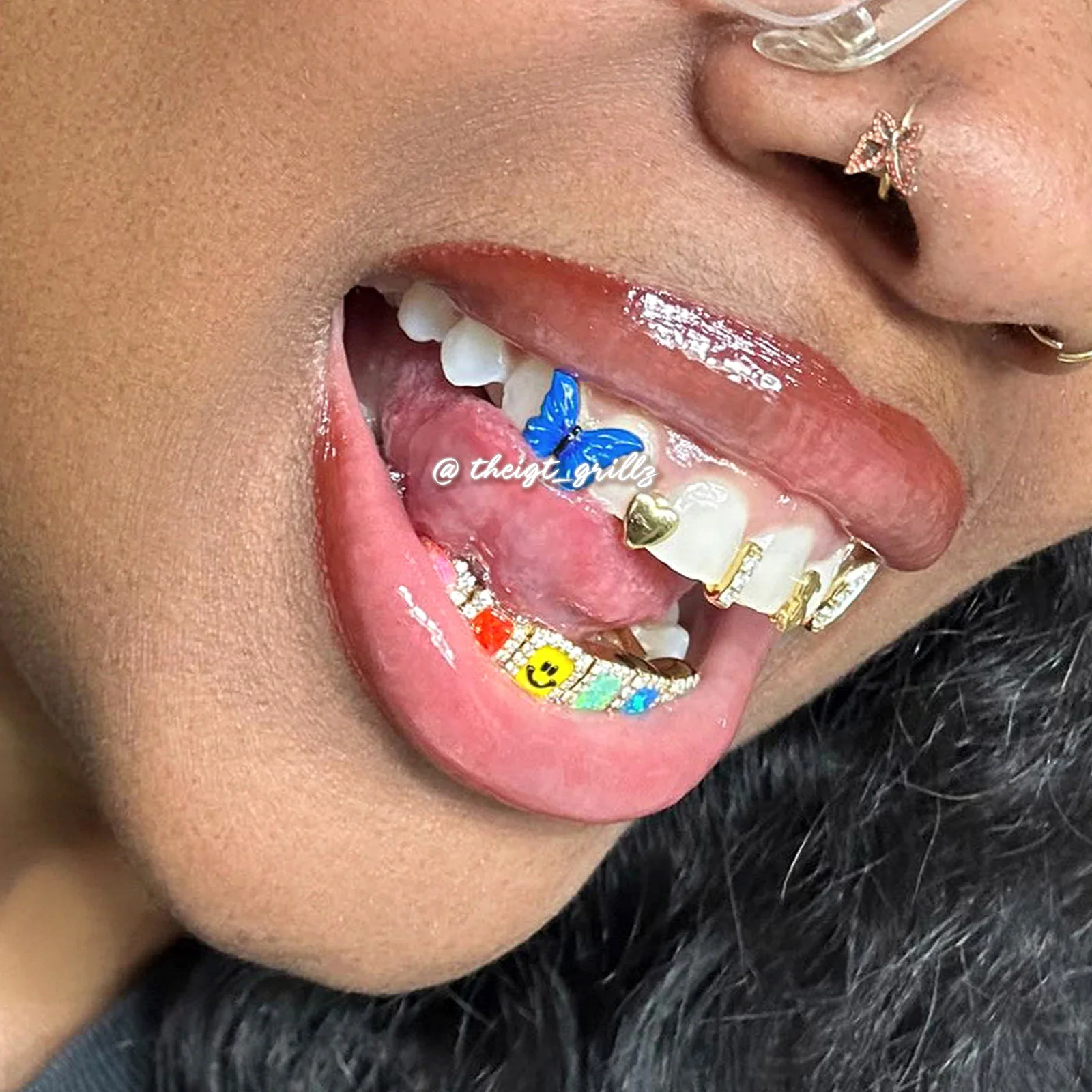 Custom Gap Bar & Colored Opal W Smile Face Grillz - Image 15