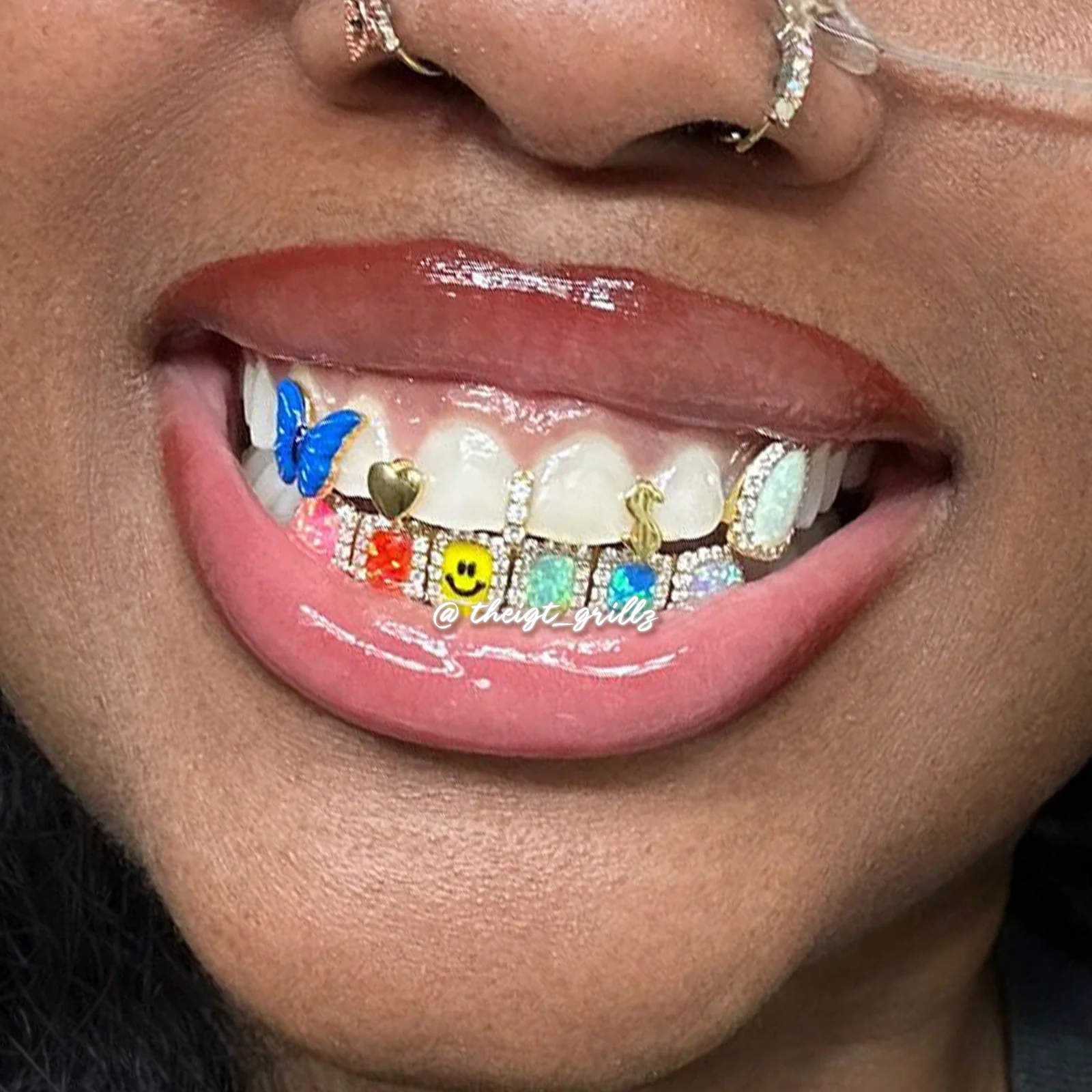 Custom Gap Bar & Colored Opal W Smile Face Grillz - Image 16