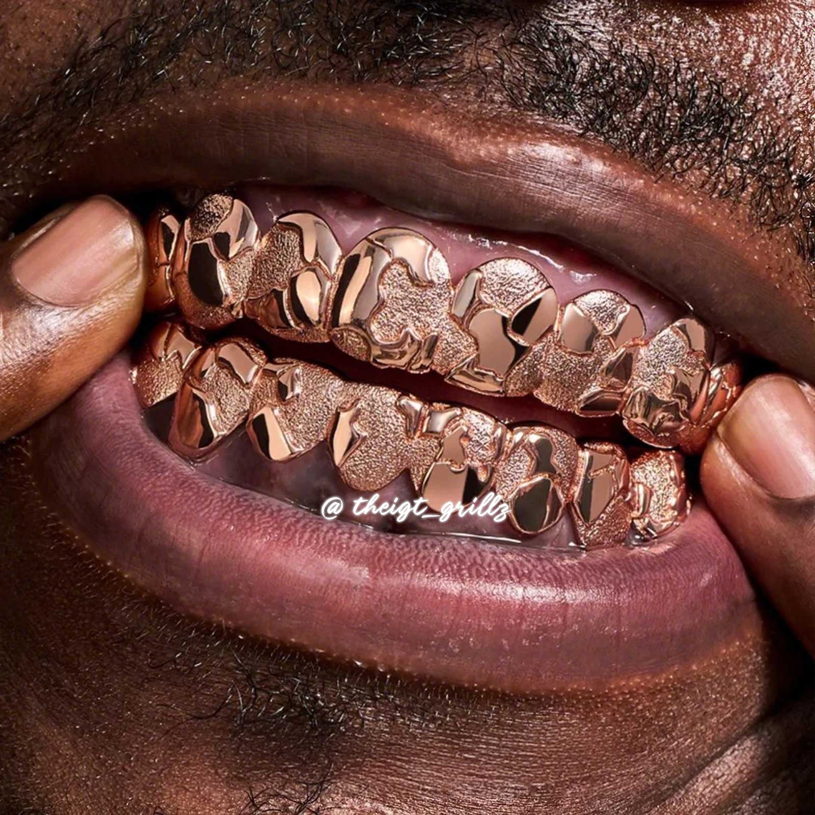 Custom Jigsaw Diamond Dust Grillz - Image 10