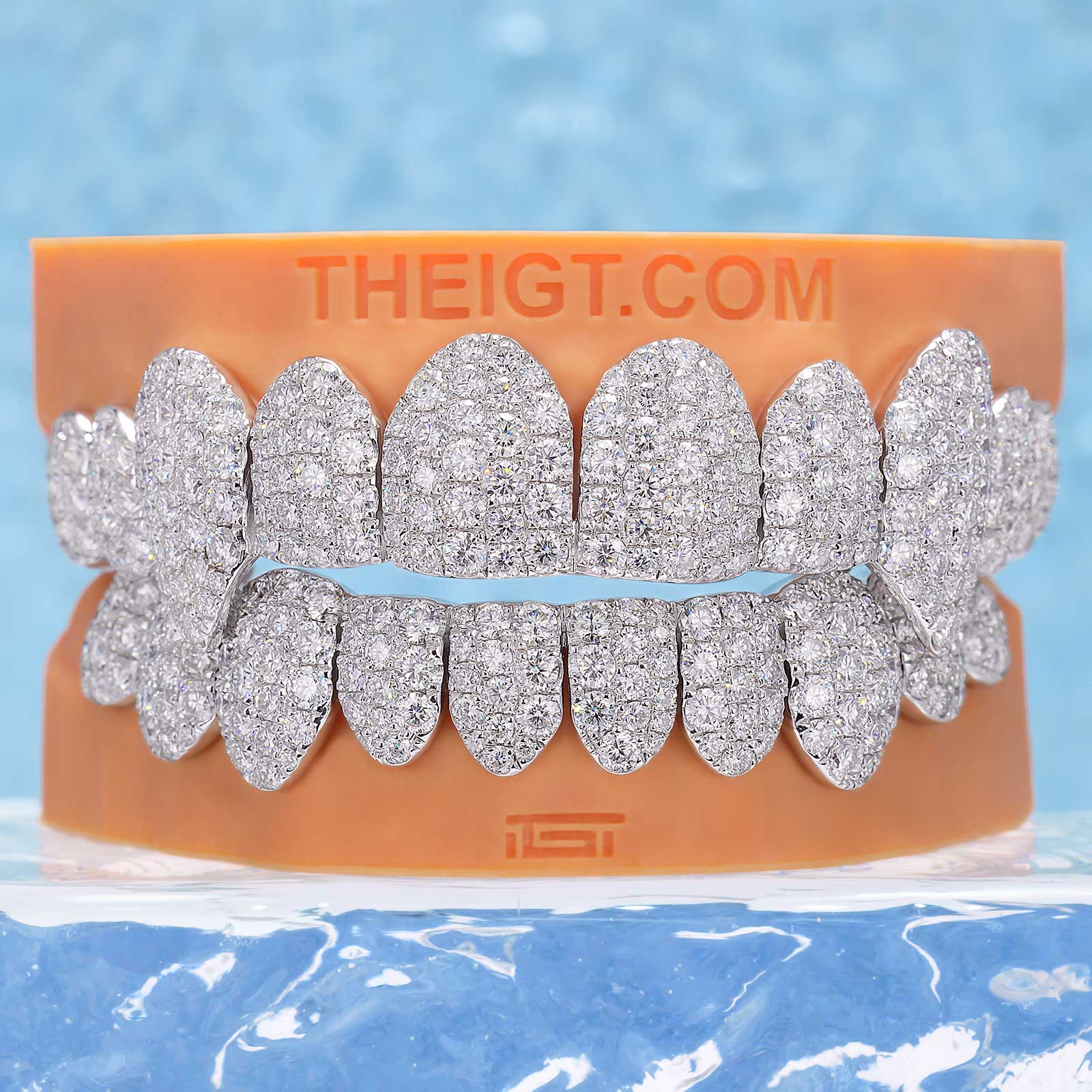 Custom Jumbo (6 Pointers) Moissanite Diamond Grillz - Image 5
