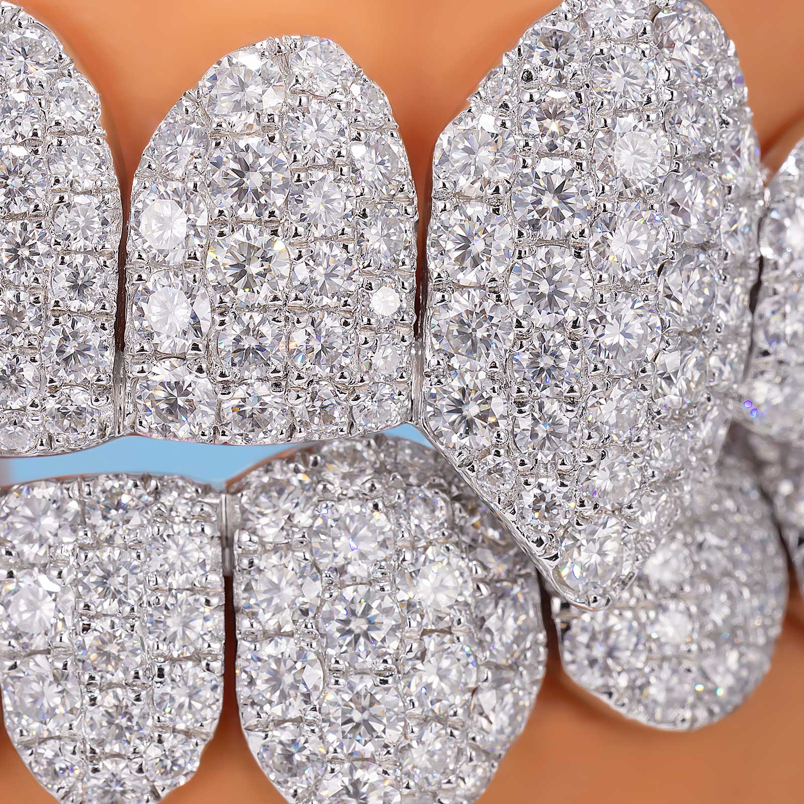 Custom Jumbo (6 Pointers) Moissanite Diamond Grillz - Image 6