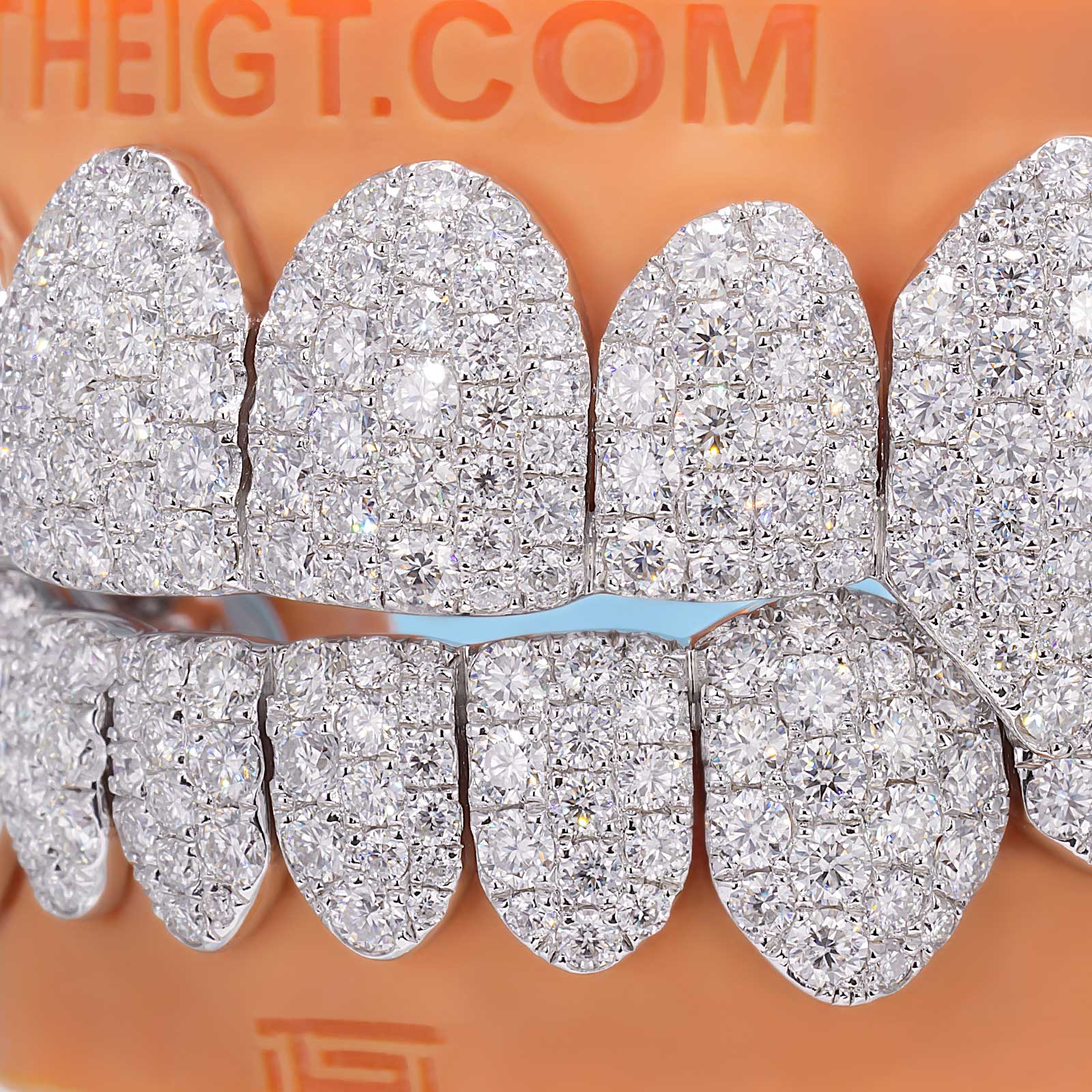 Custom Jumbo (6 Pointers) Moissanite Diamond Grillz - Image 7