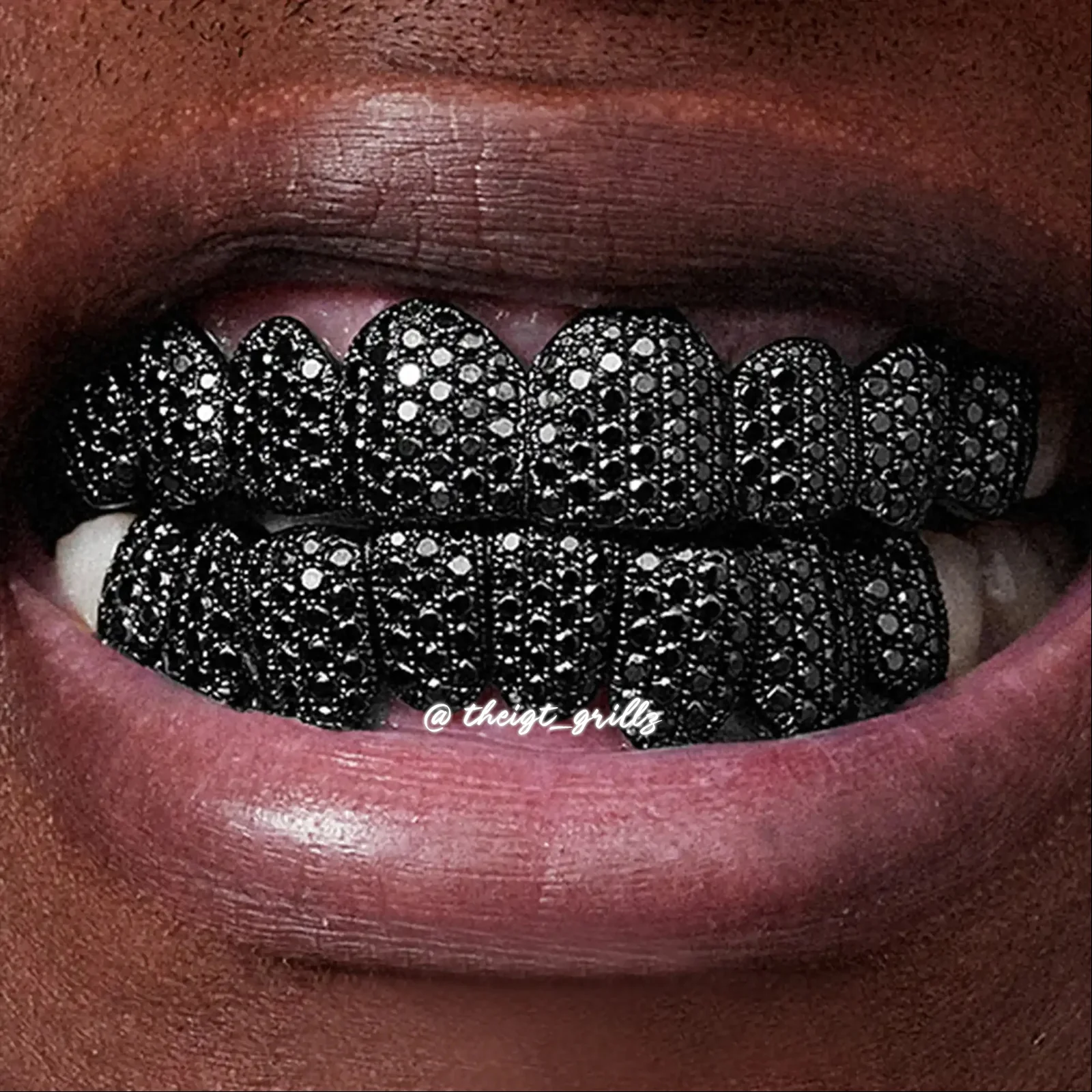 Custom Pave/Honeycomb Black Moissanite Grillz - Image 5