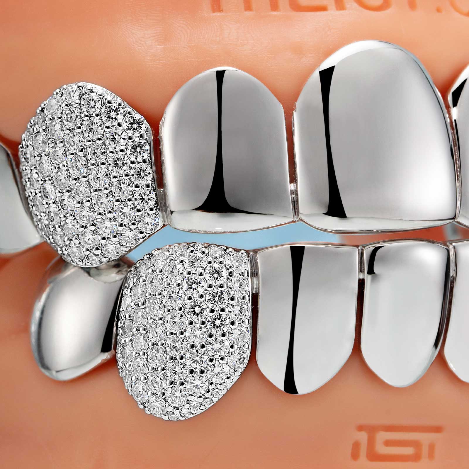 Custom Polished Gold & Diamond Grillz - Image 5