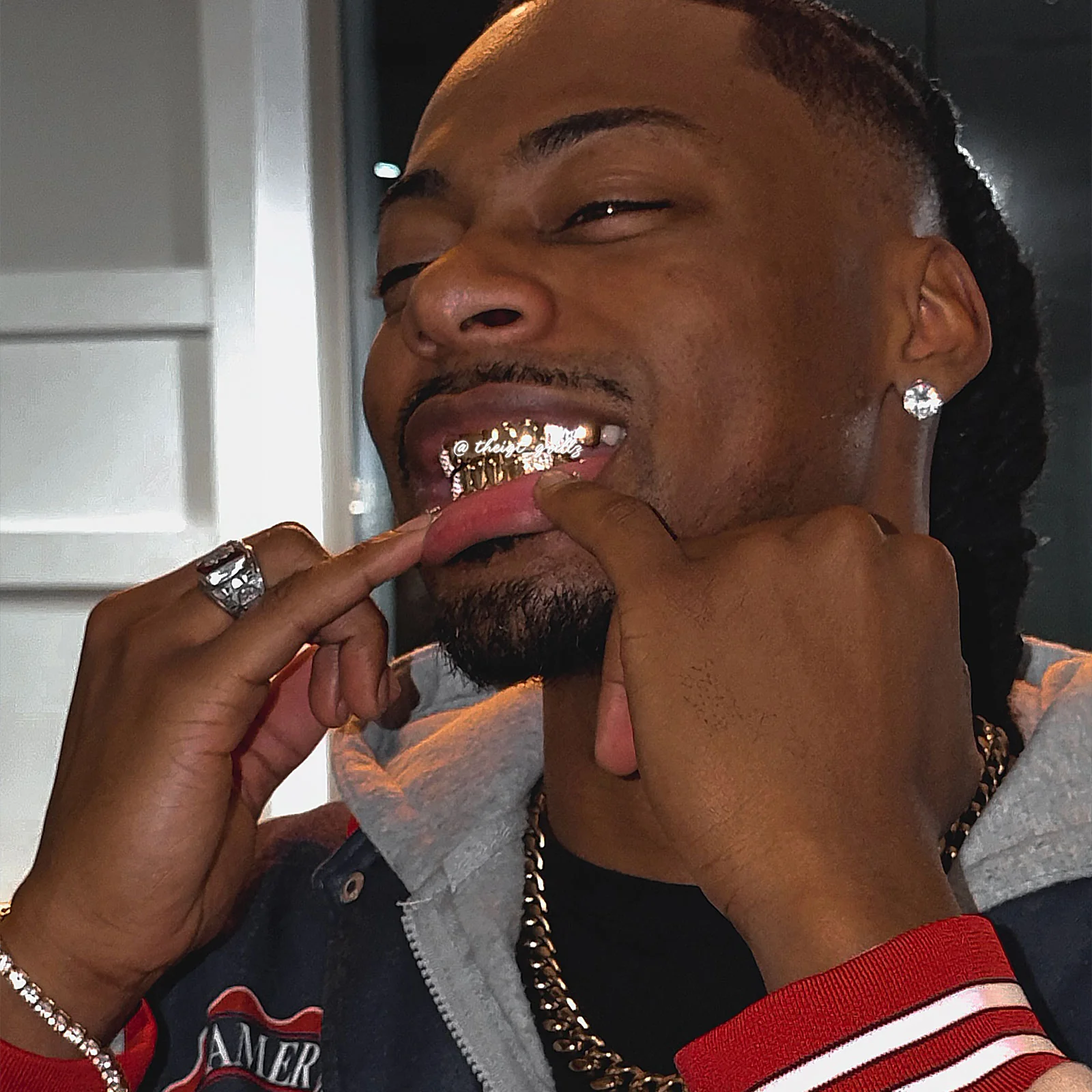 Custom Polished Gold & Diamond Grillz - Image 8