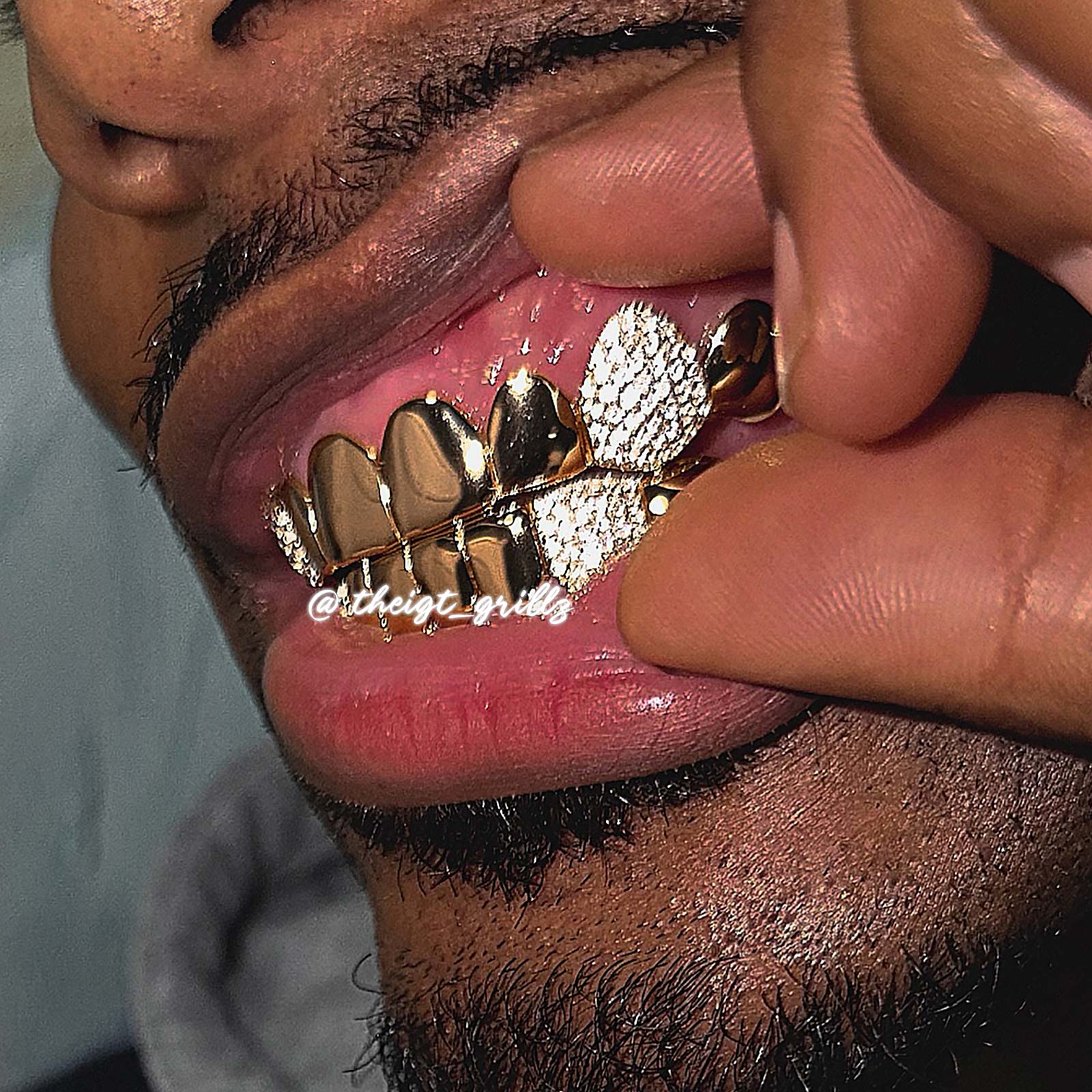 Custom Polished Gold & Diamond Grillz - Image 9