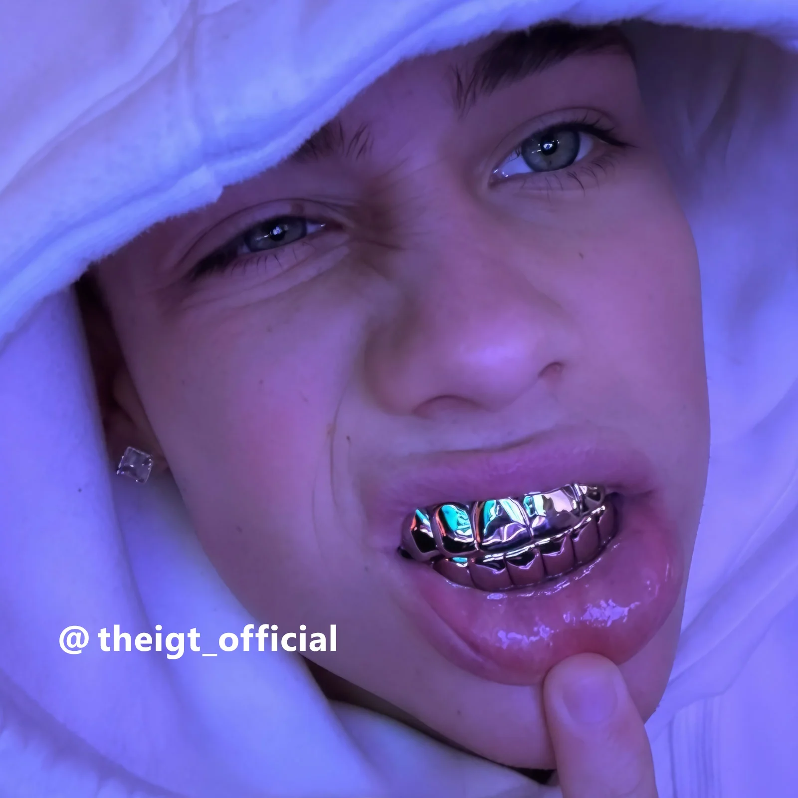 Custom Polished White Gold Grillz - Image 4