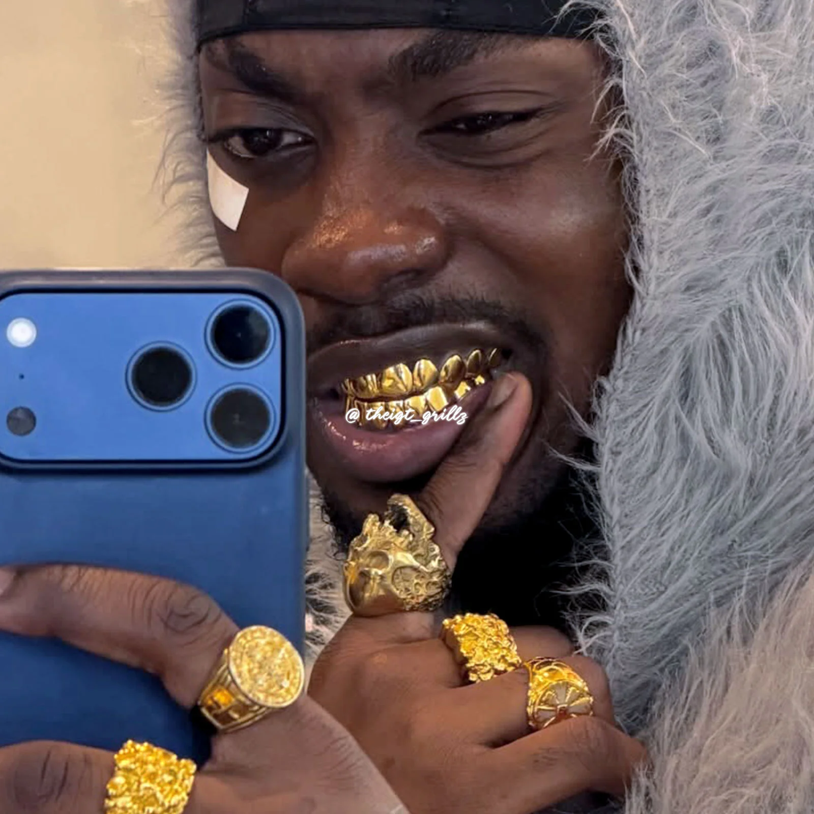 Custom Polished Yellow Gold Grillz - Image 3
