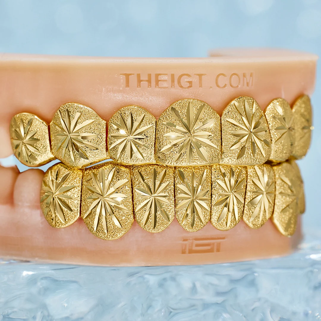 Custom Sunburst Cuts Grillz - Image 4