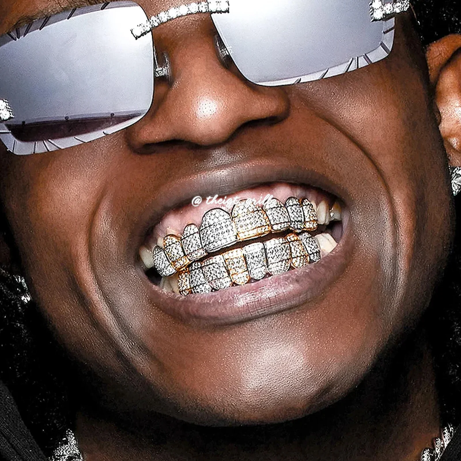 Custom Tri-Colored Diamond Grillz - Image 4