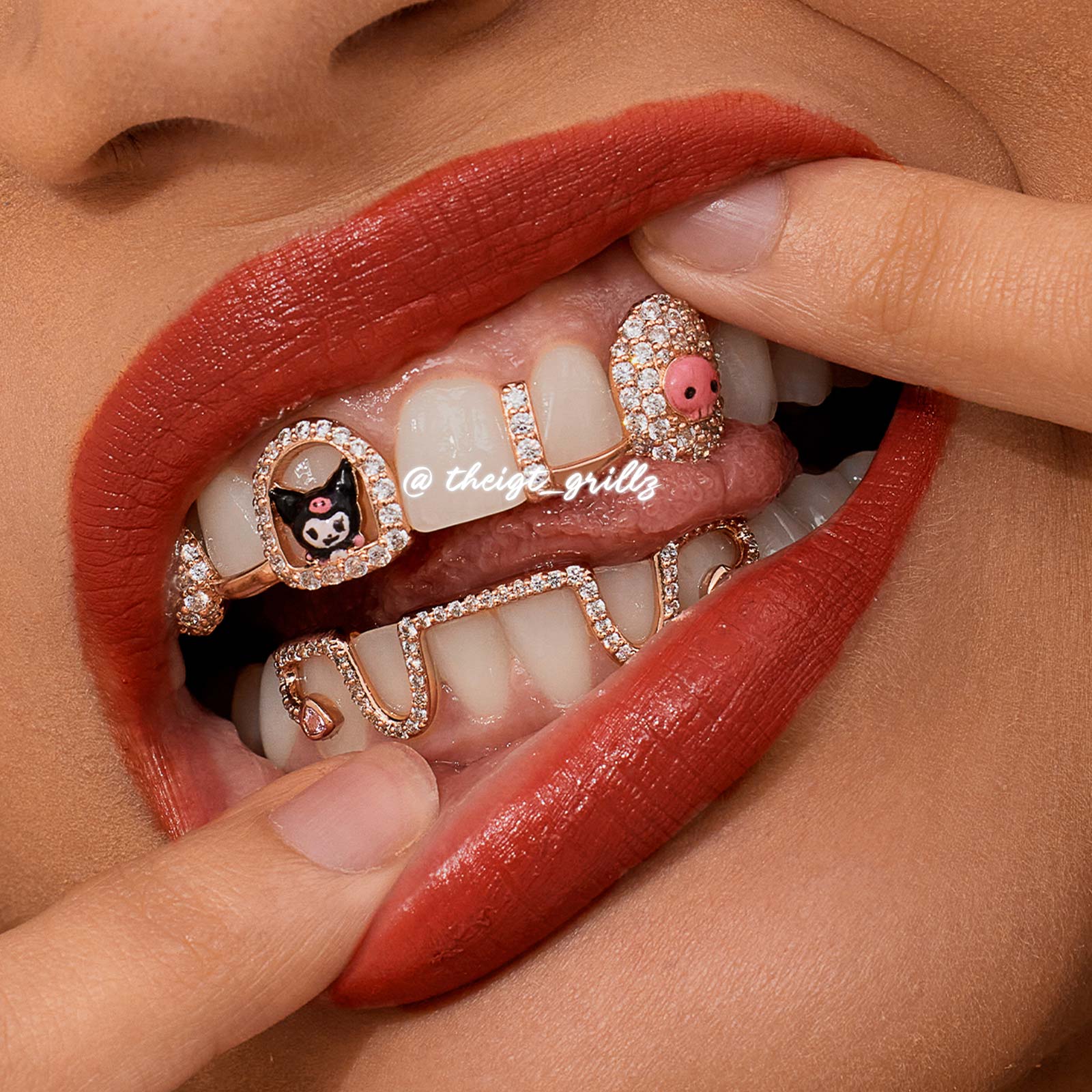 Dark Kawaii Skull Custom Grillz - Image 7