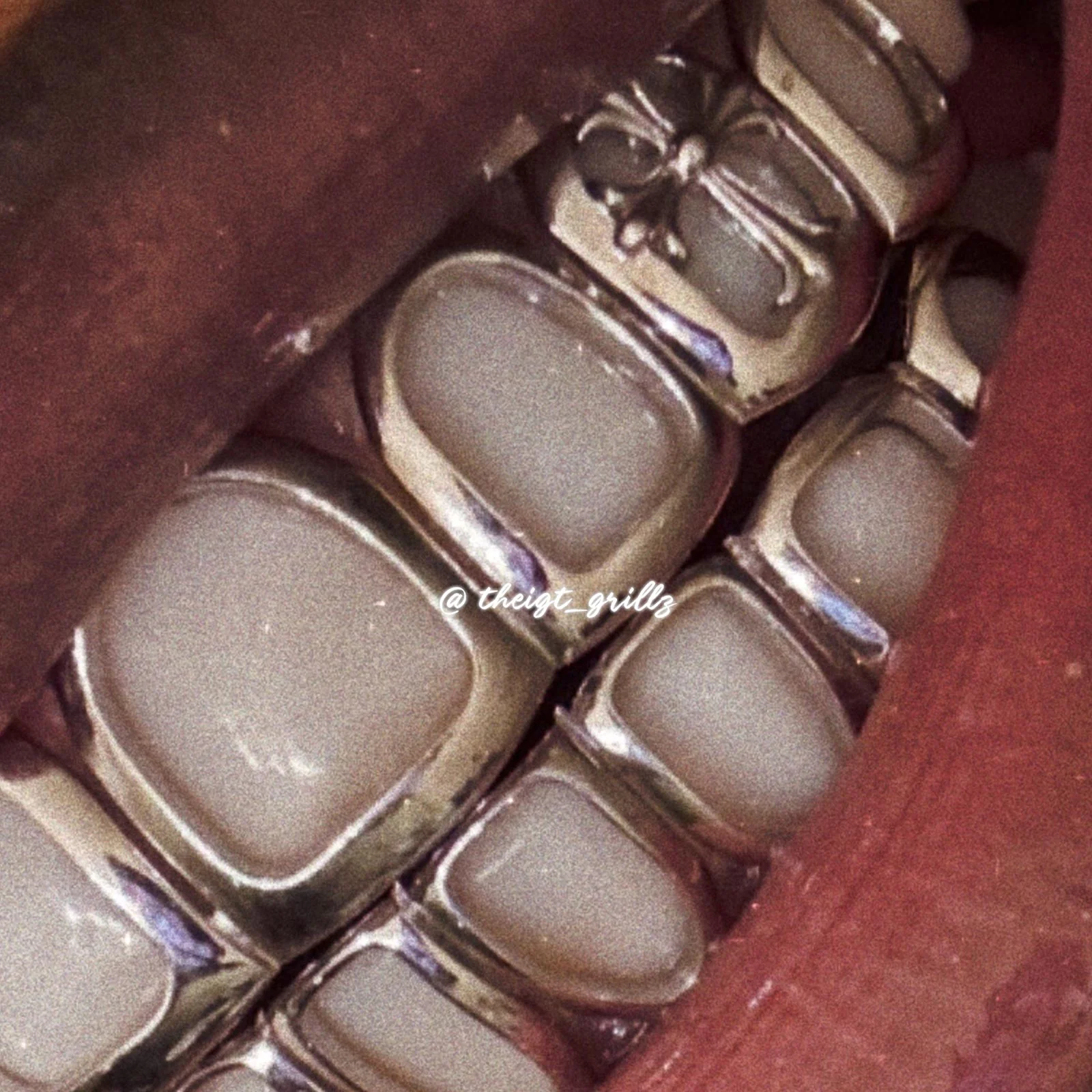 Double Cross Open Face Grillz - Image 9