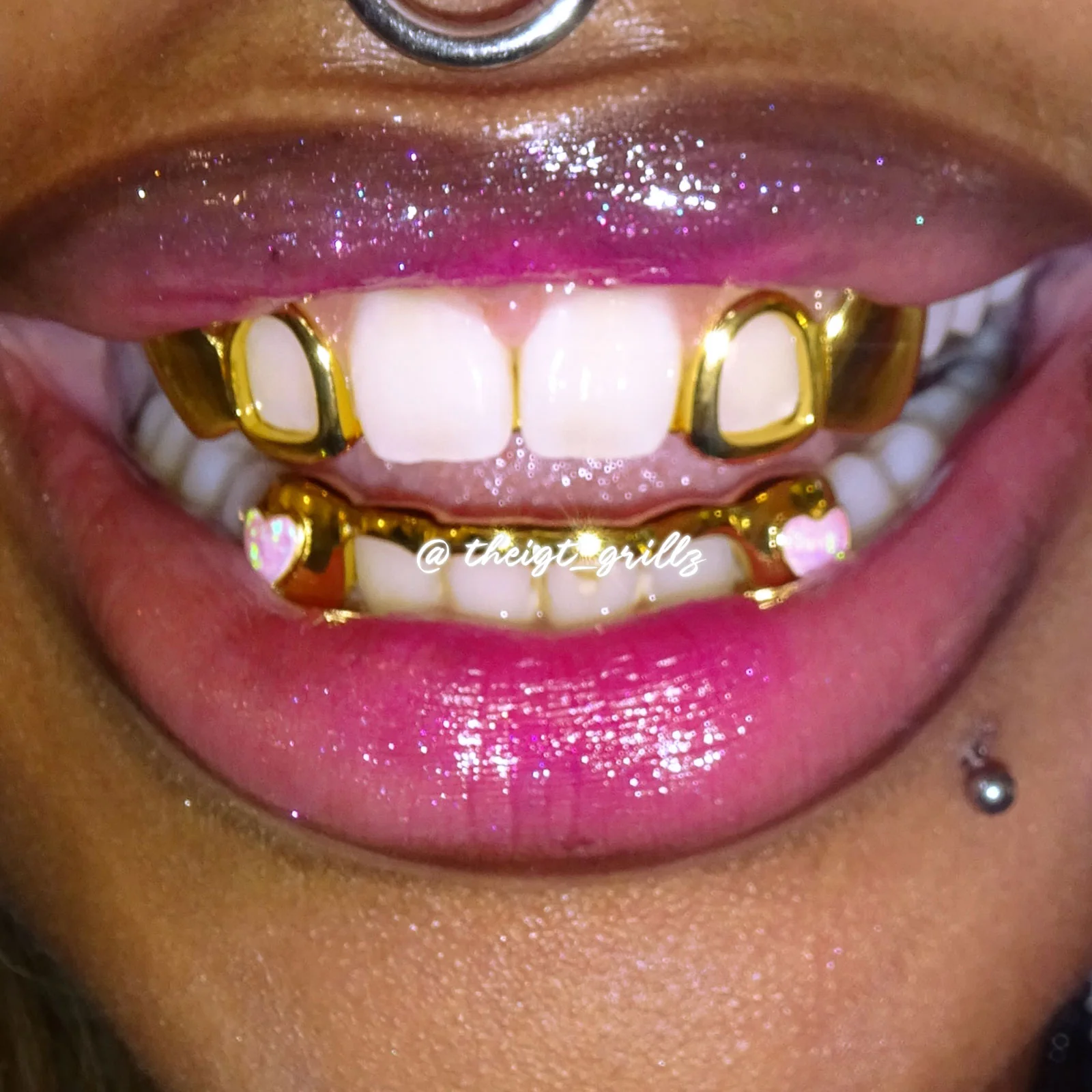 Heart Opal Bridge Grillz - Image 7