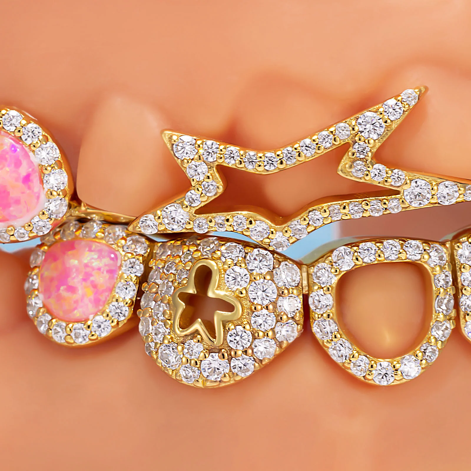 "Iced Star" Signature Custom Grillz - Image 2