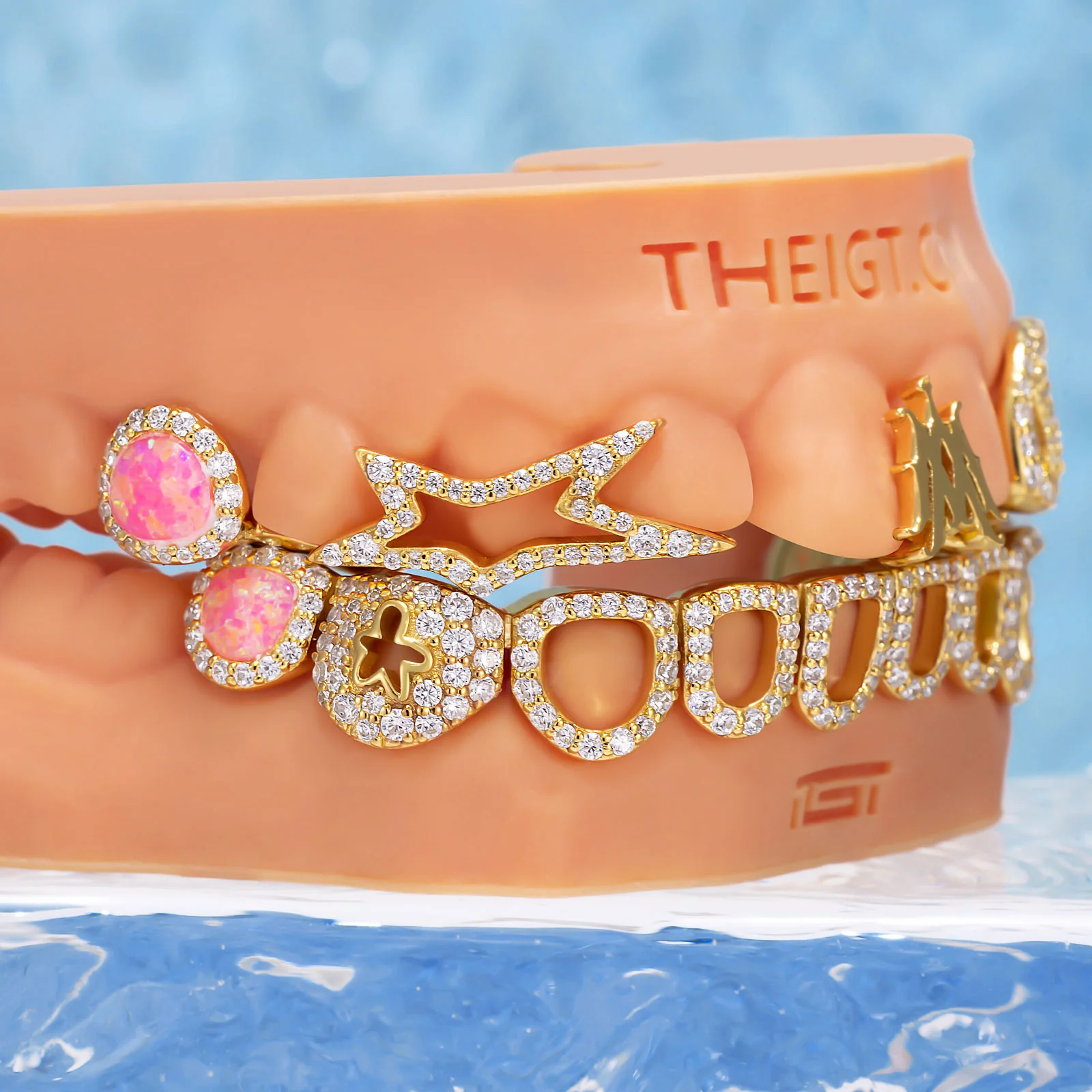 "Iced Star" Signature Custom Grillz - Image 4