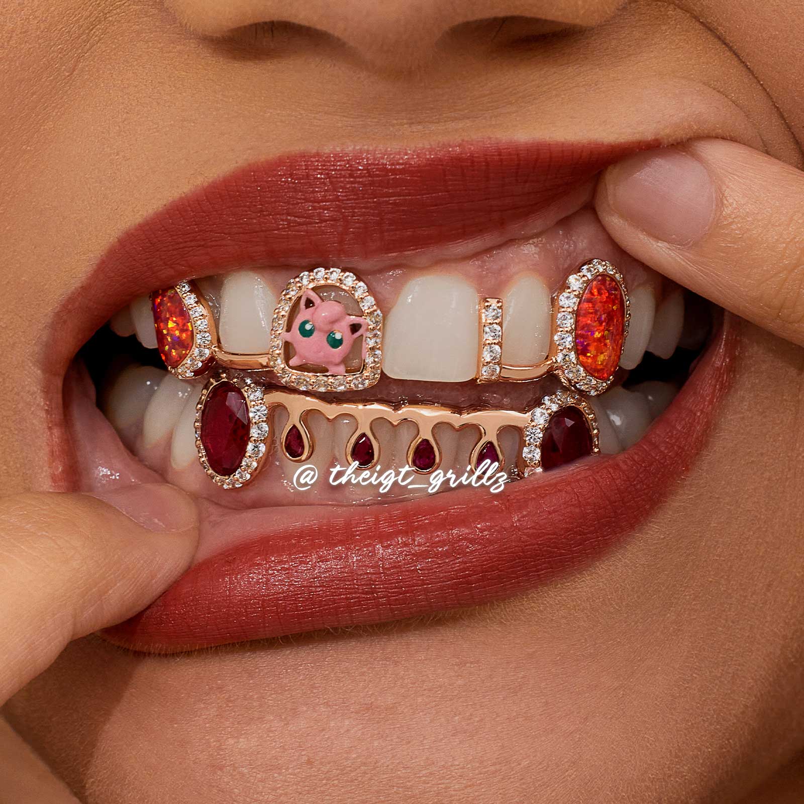 Jigglypuff Style Bar Grillz - Image 4