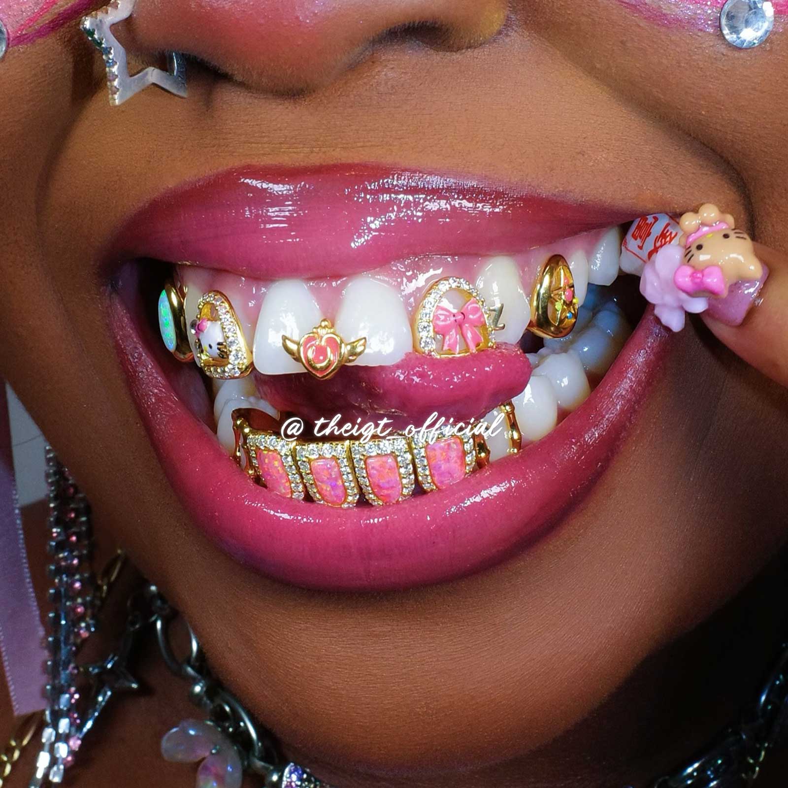 Kitty & Opal Diamond Grillz - Image 8