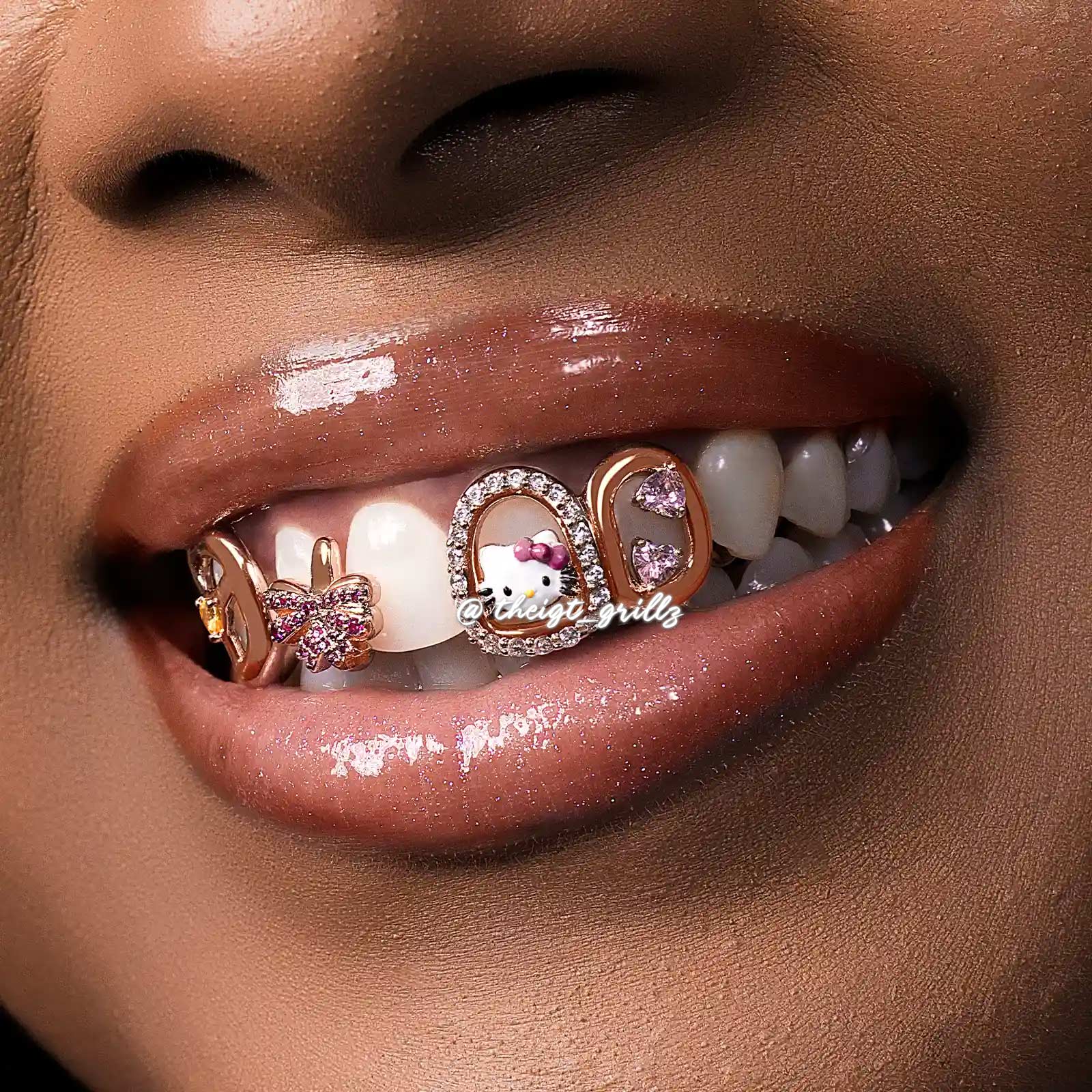 Kitty's Style Grillz - Image 5