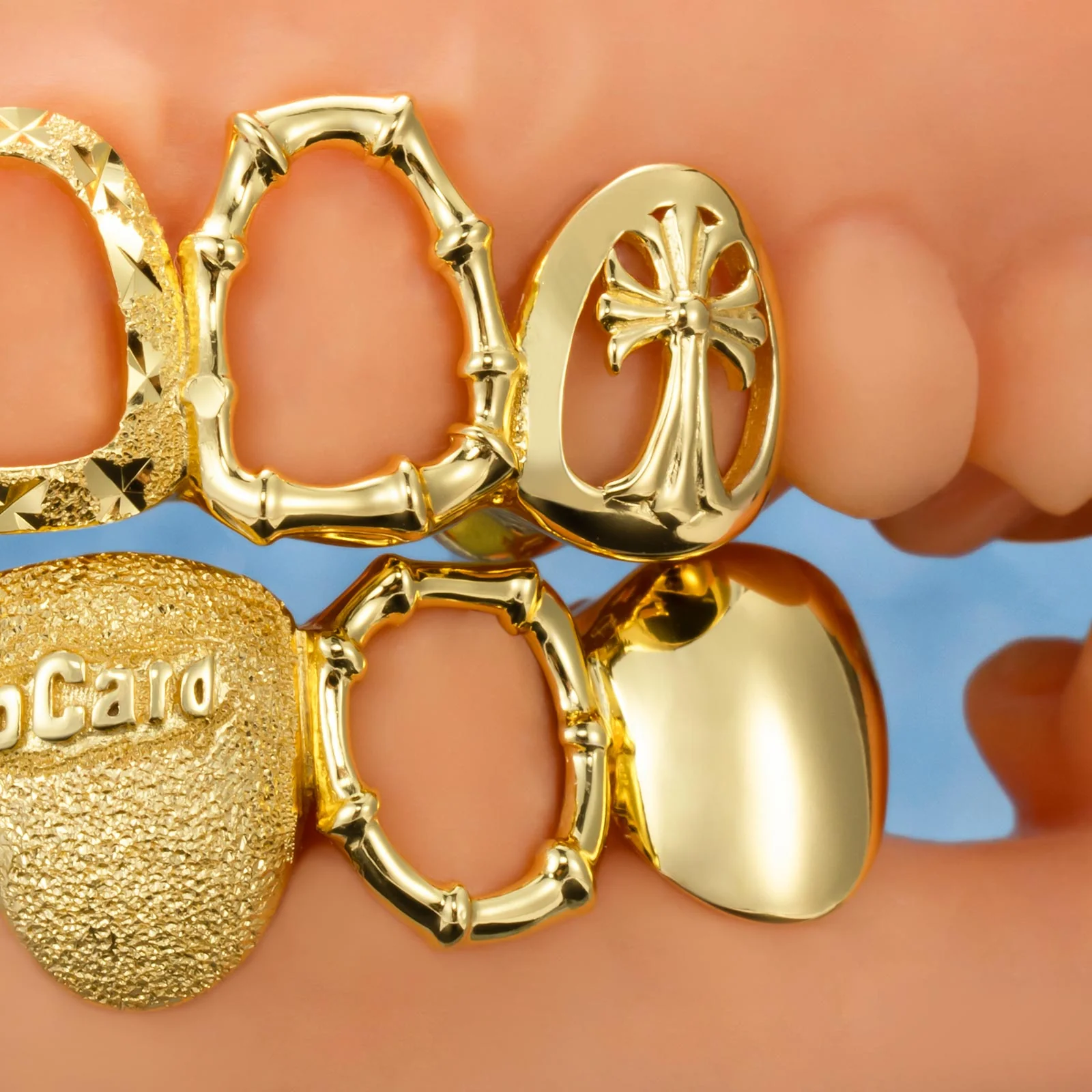Metro Yankee Muse Grillz - Image 5