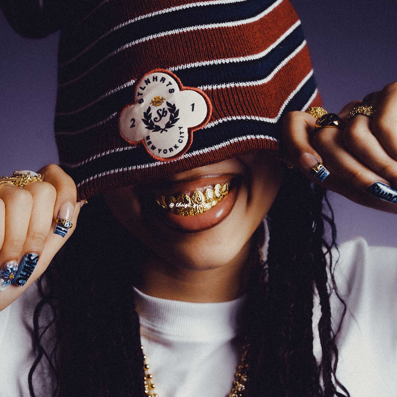 Molten Gold Liquid Metal Grillz - Image 5