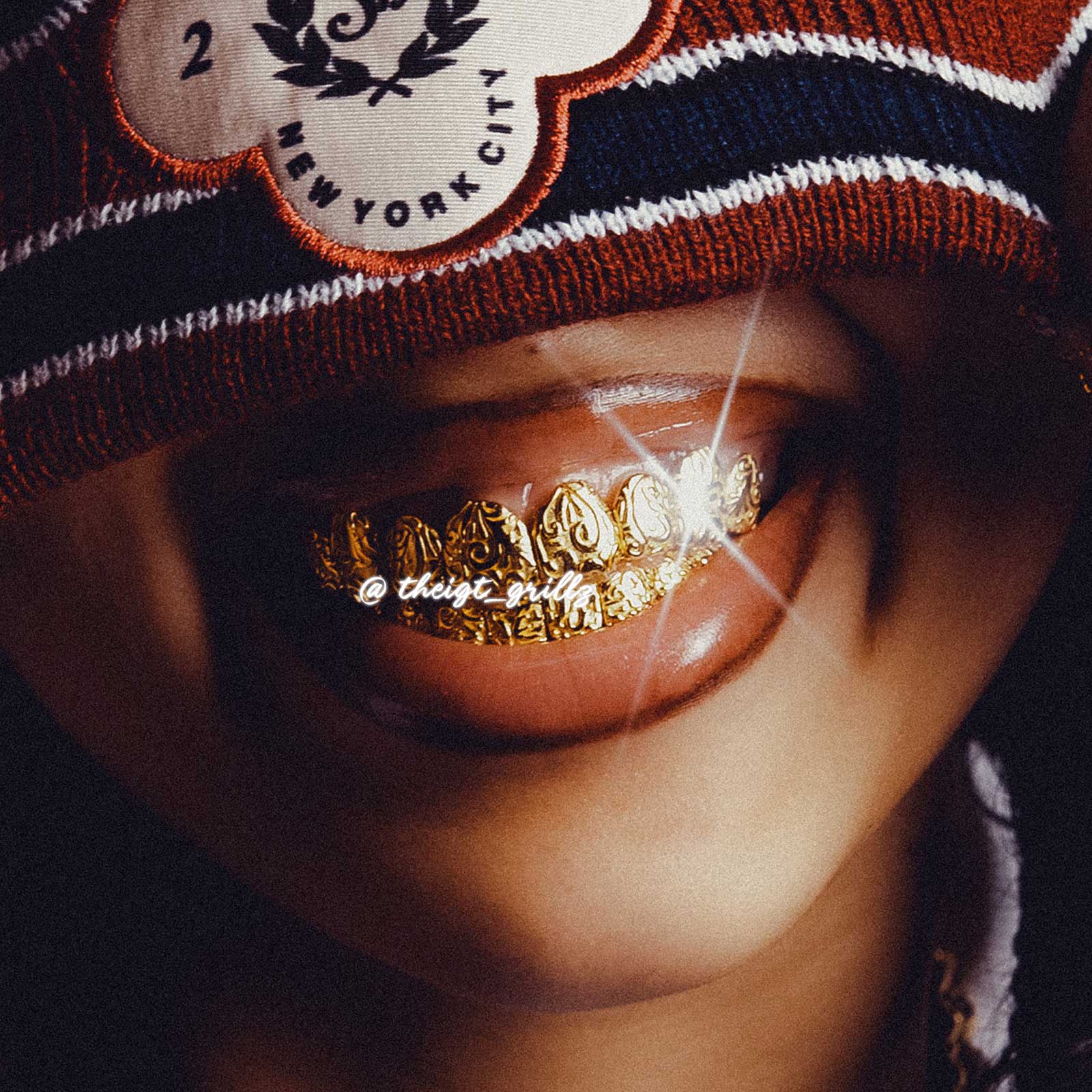 Molten Gold Liquid Metal Grillz - Image 6