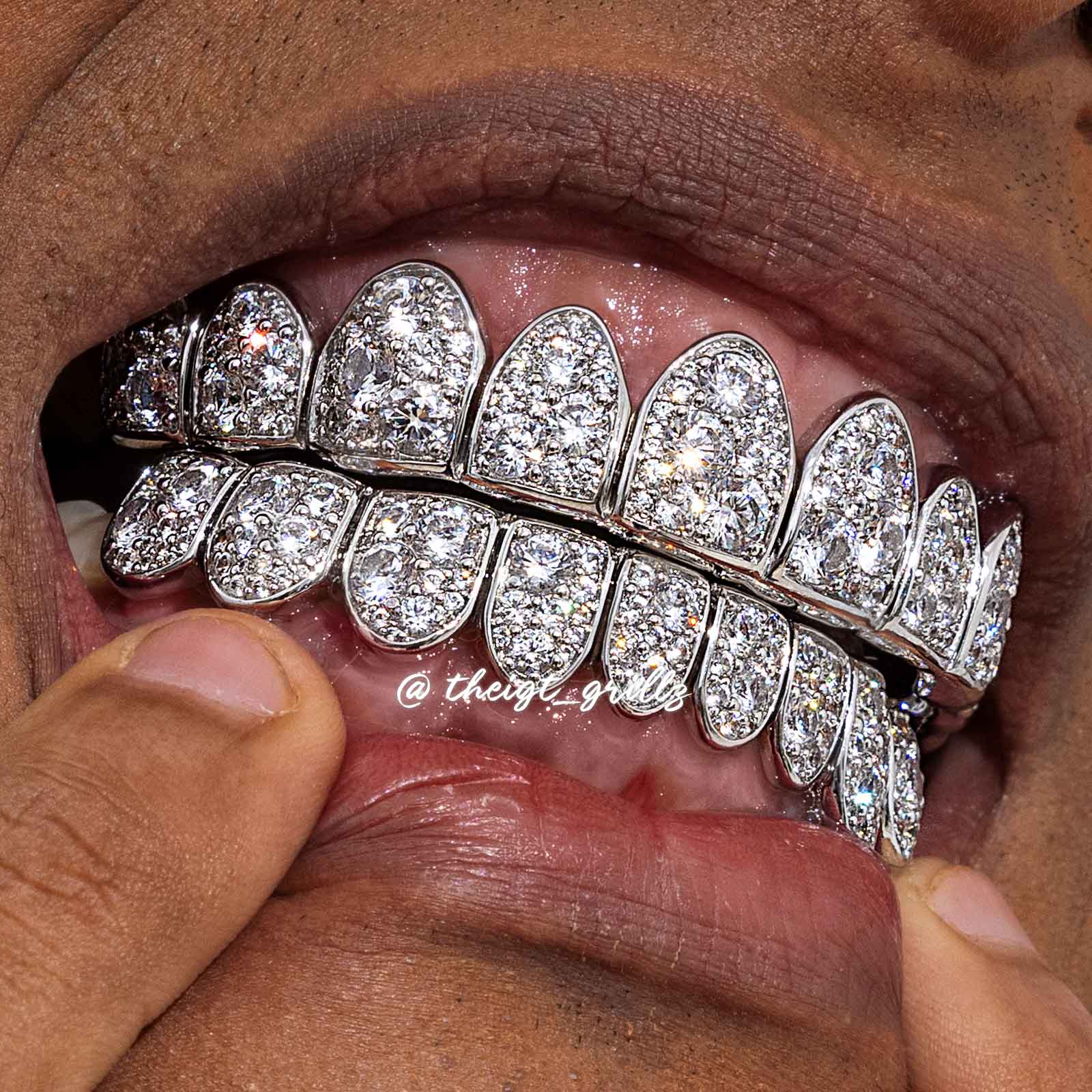 Mosaic/Snow Set Moissanite Diamond Grillz - Image 11