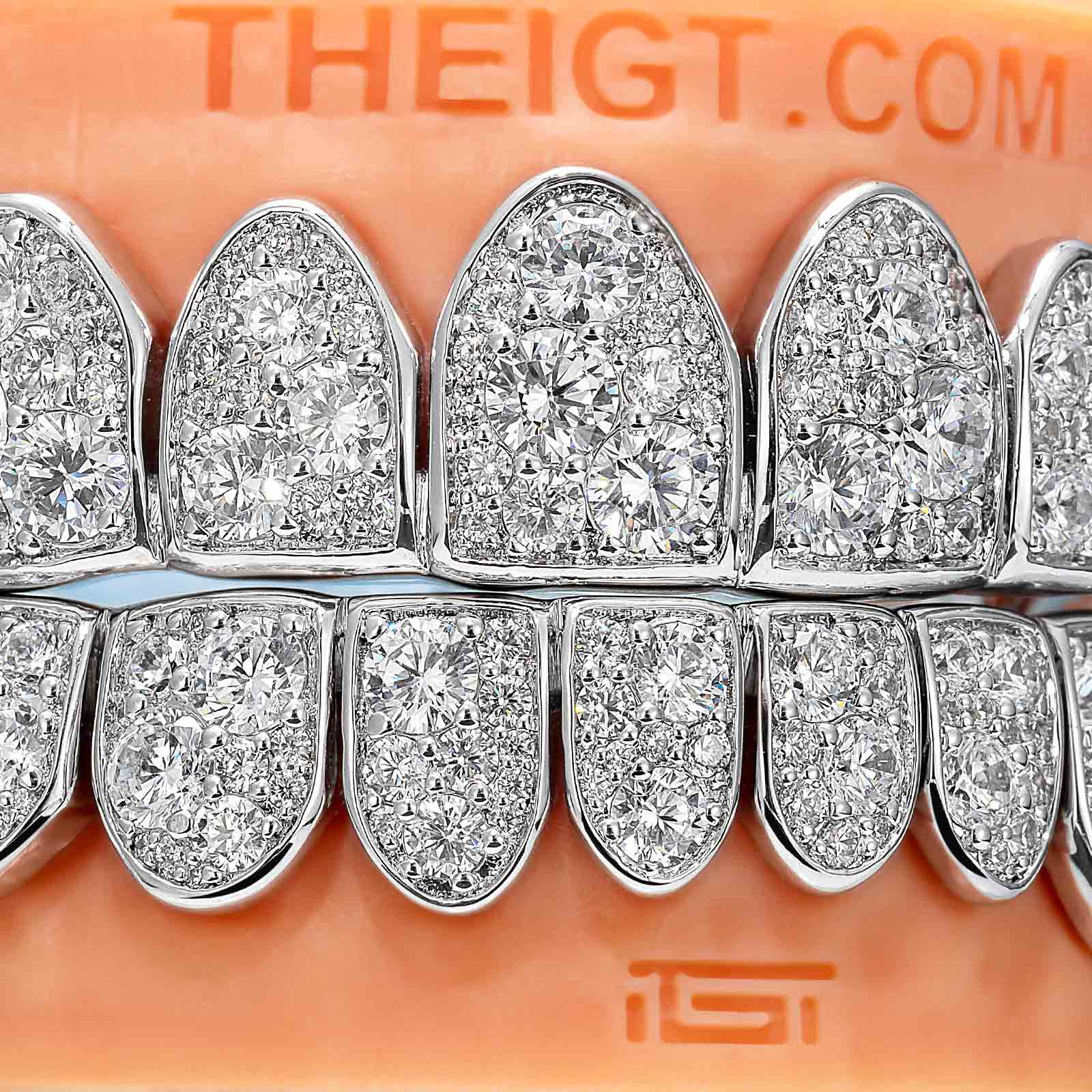 Mosaic/Snow Set Moissanite Diamond Grillz - Image 5
