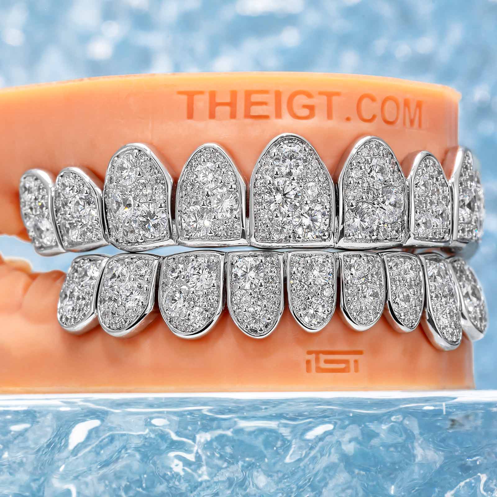 Mosaic/Snow Set Moissanite Diamond Grillz - Image 6