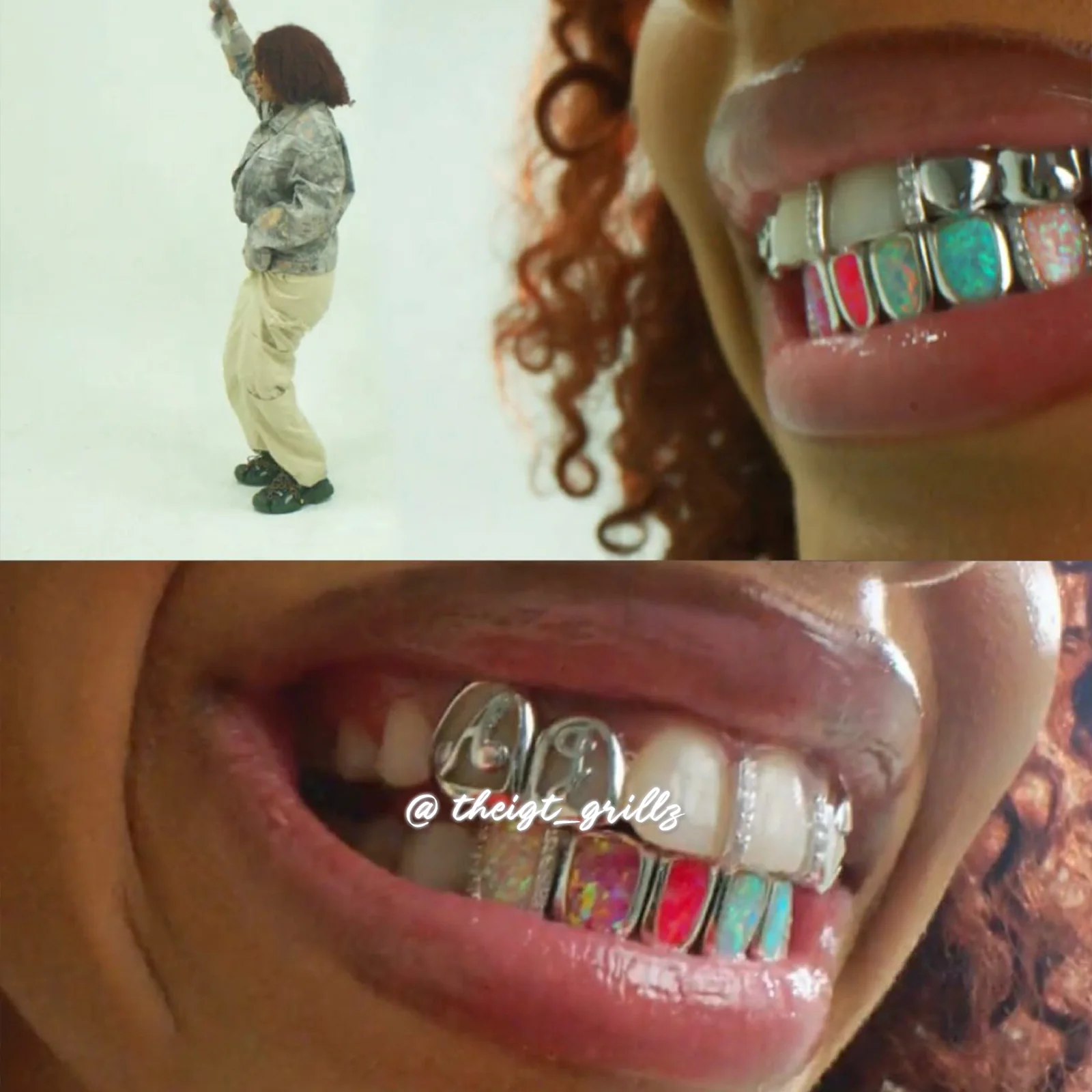 Multi-Opal & AJ Letter Grillz - Image 8