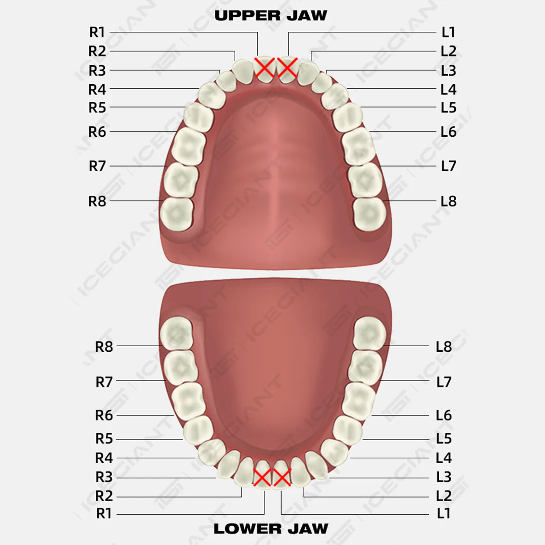 Opal With Oval Cut Style Grillz - Image 4