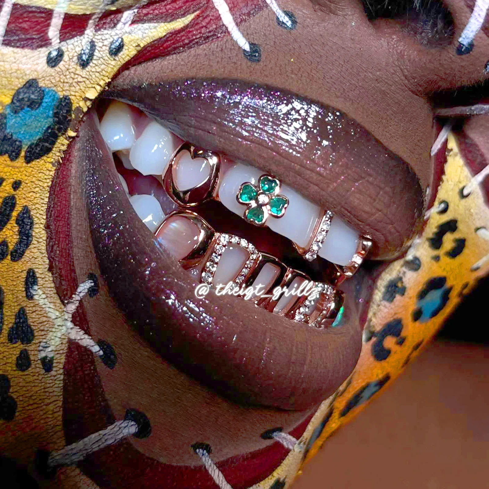 Open Face Pink Charm Grillz - Image 8