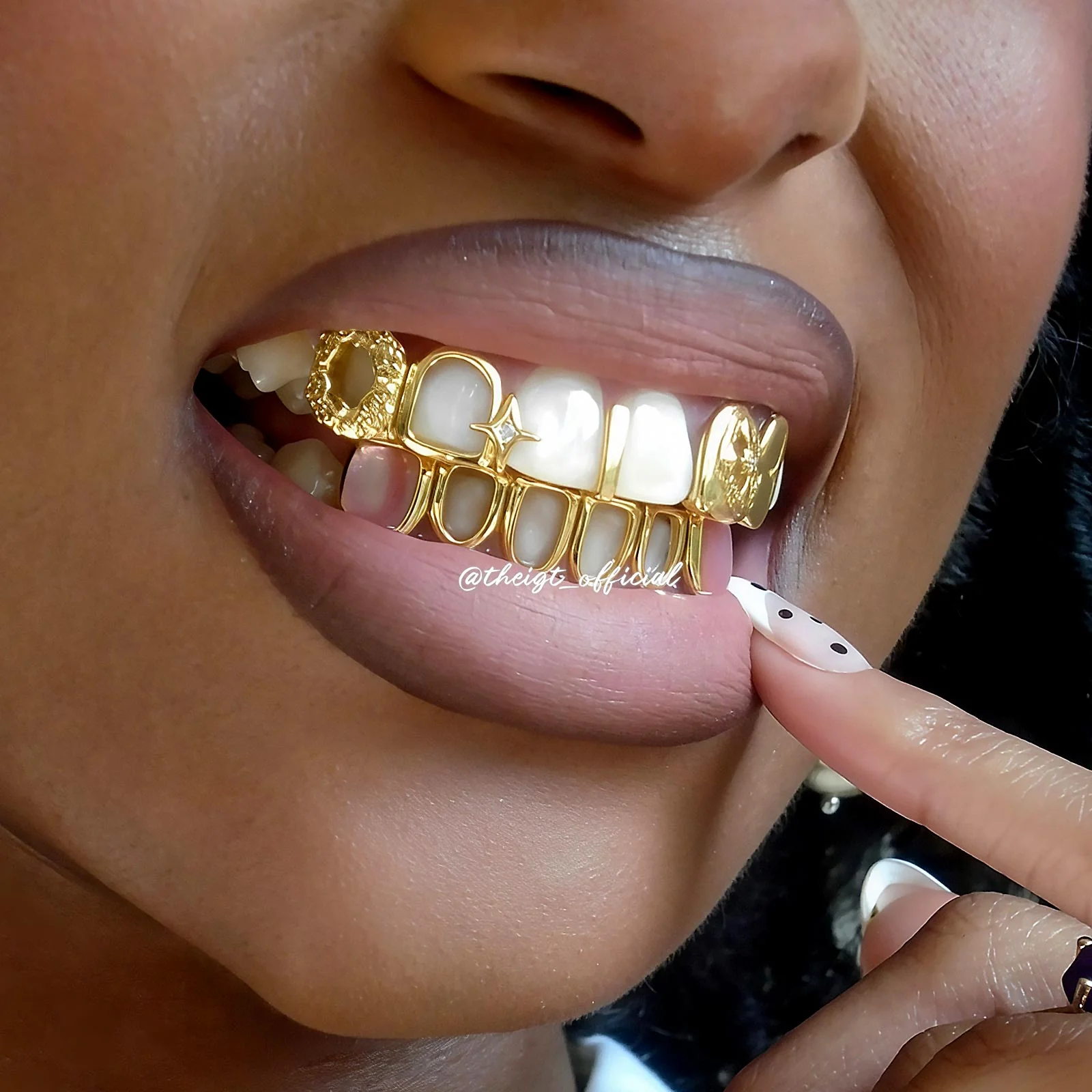 Open Face & Pink Shell Grillz - Image 14
