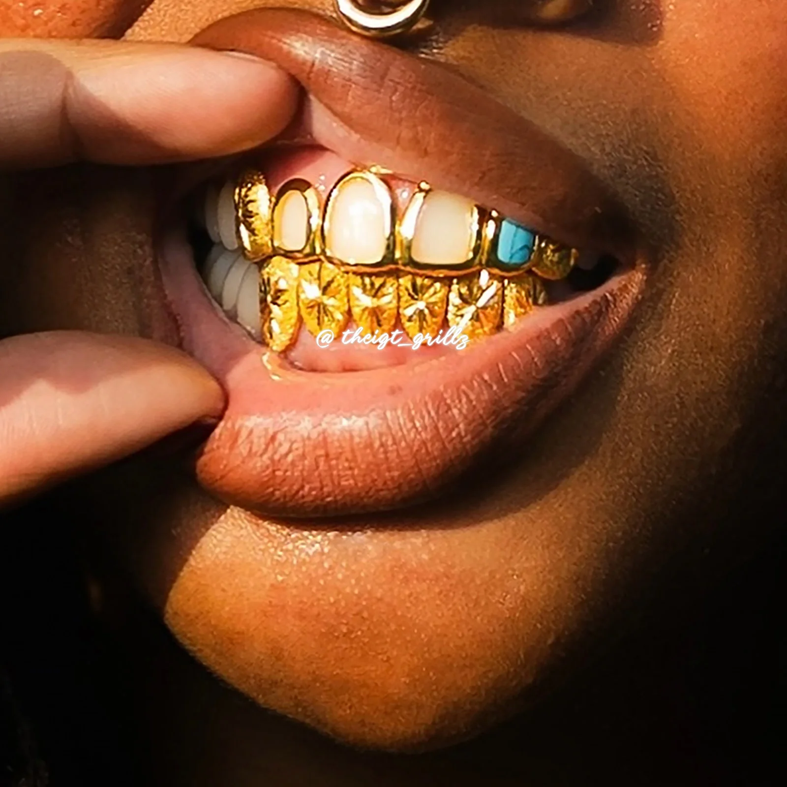 Open Face W Bottom Sunburst Grillz - Image 6