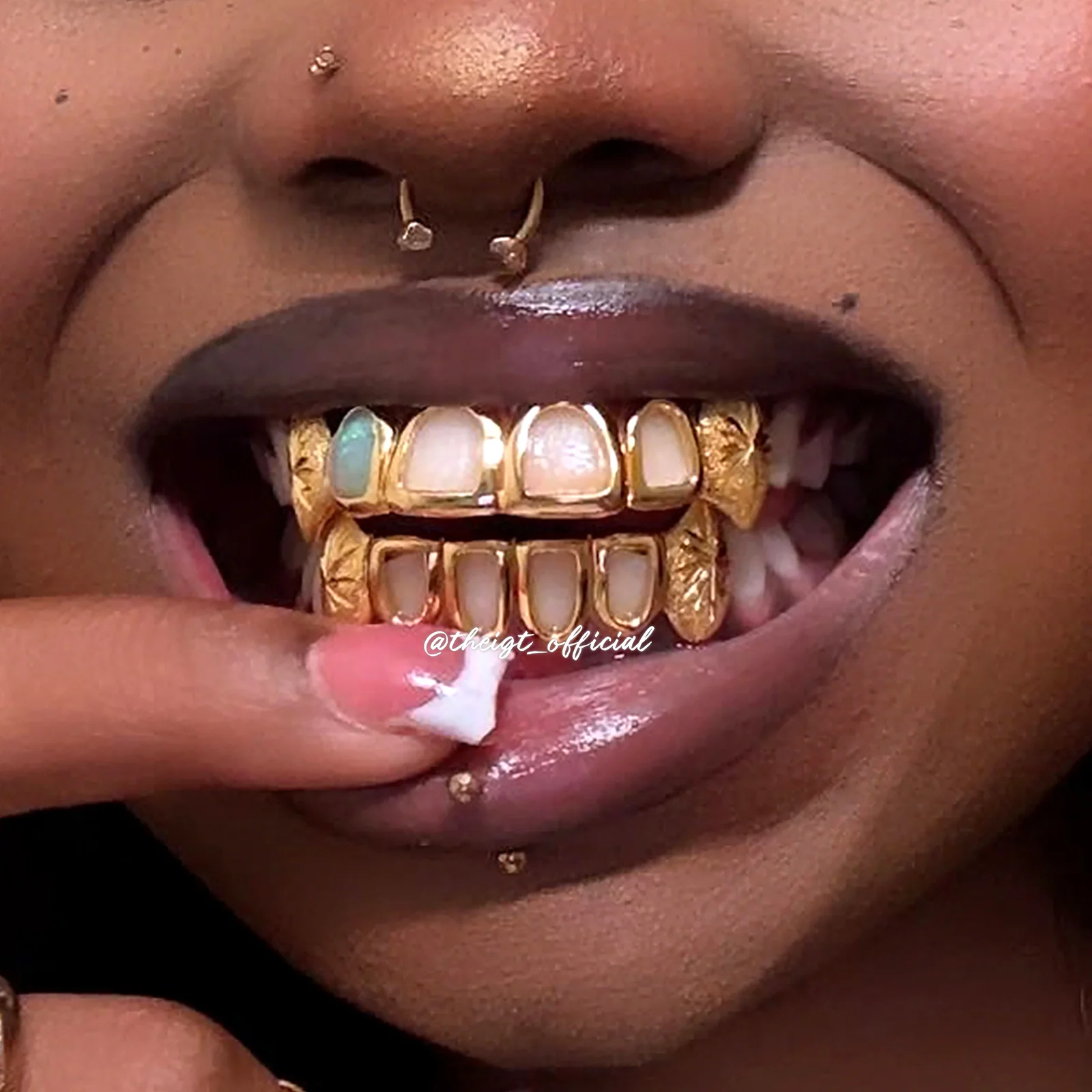 Open Face W Sunburst On Fang Grillz - Image 5