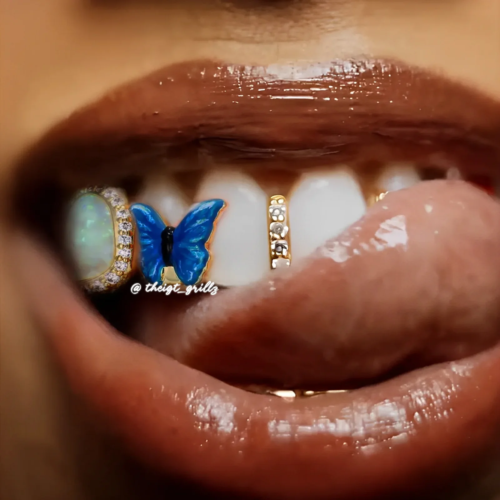 Open Face With Butterfly Gap Bar - Image 12