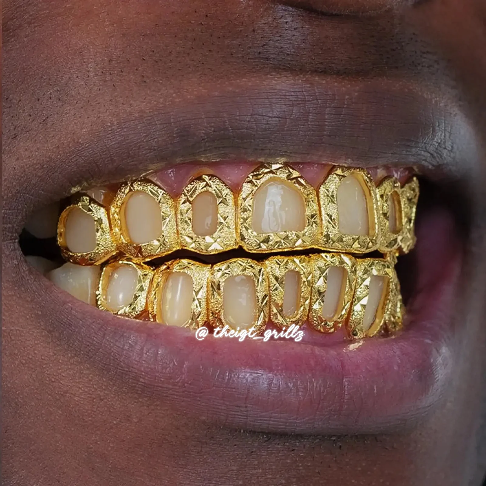 Open Face With Diamond Cut And Diamond Dust Grillz - Image 7