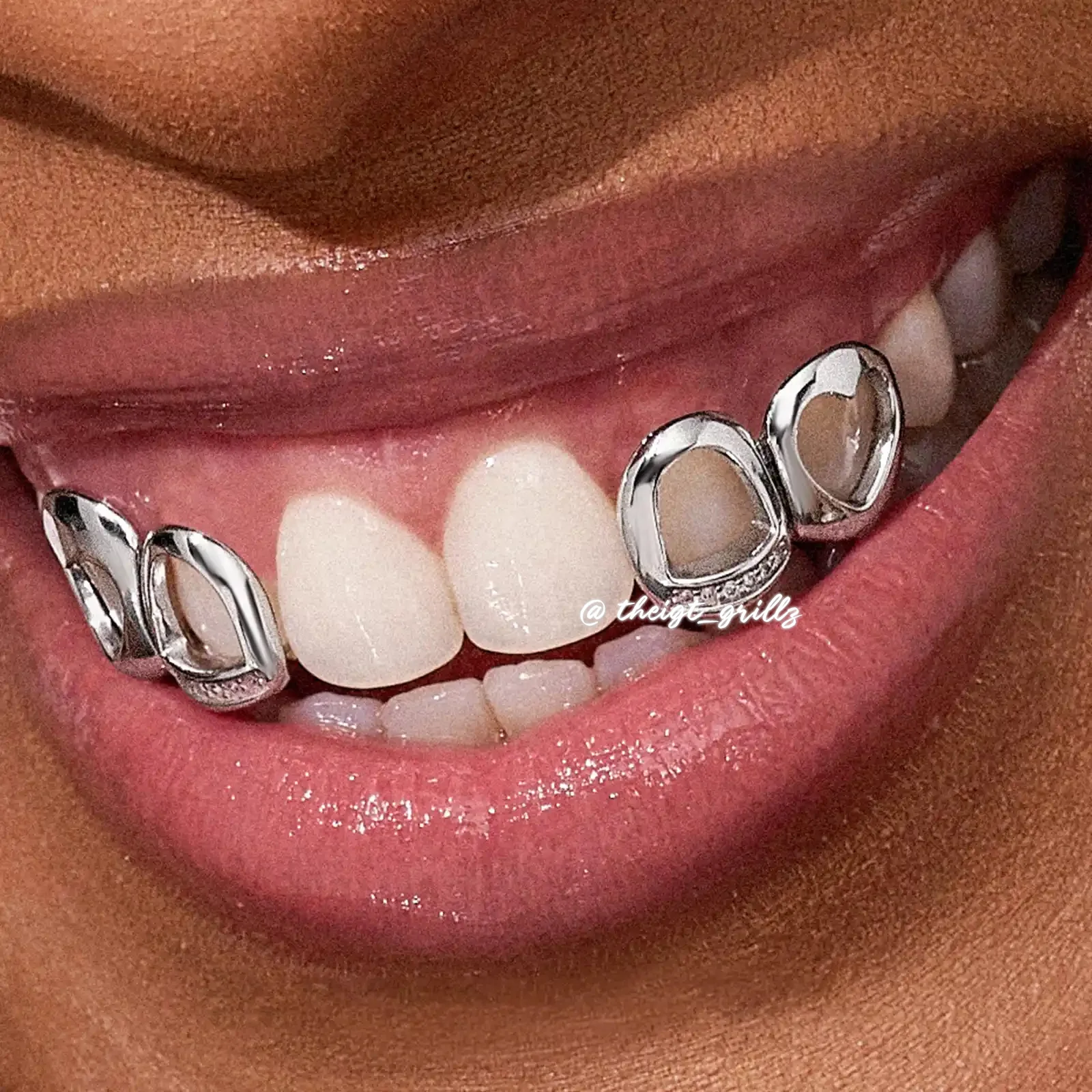 Open Face With Heart Style Grillz - Image 5