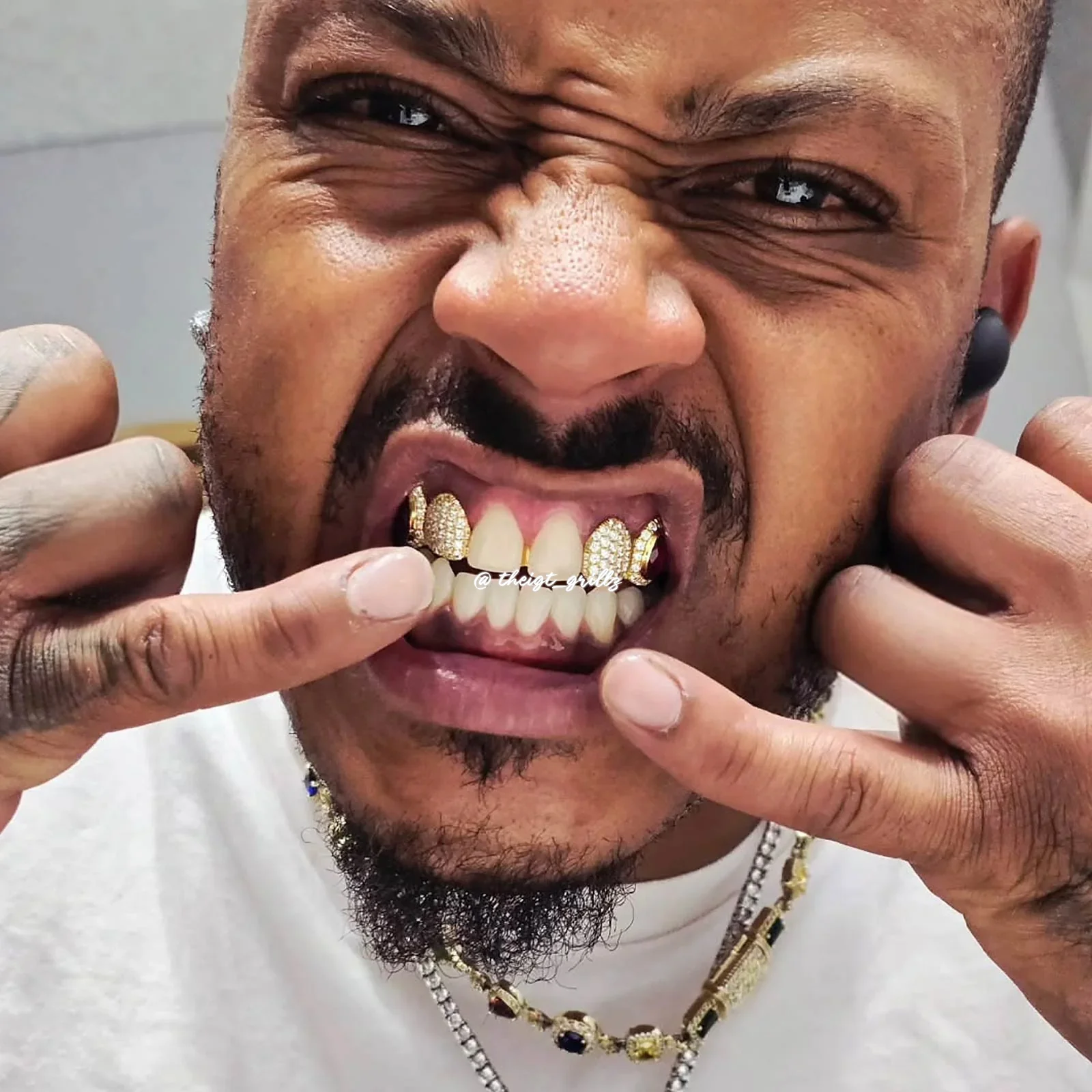 Pave & Bezel Set w Pear Cut Drip Diamond Grillz - Image 3